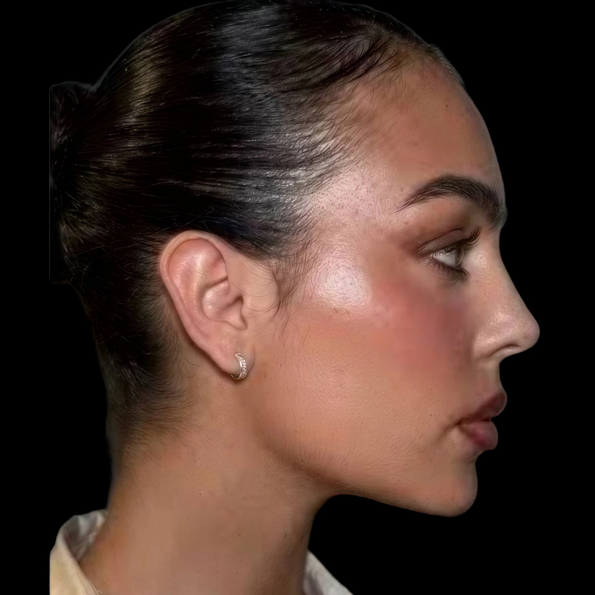 Georgina Rodriguez, Submental Cervical Angle