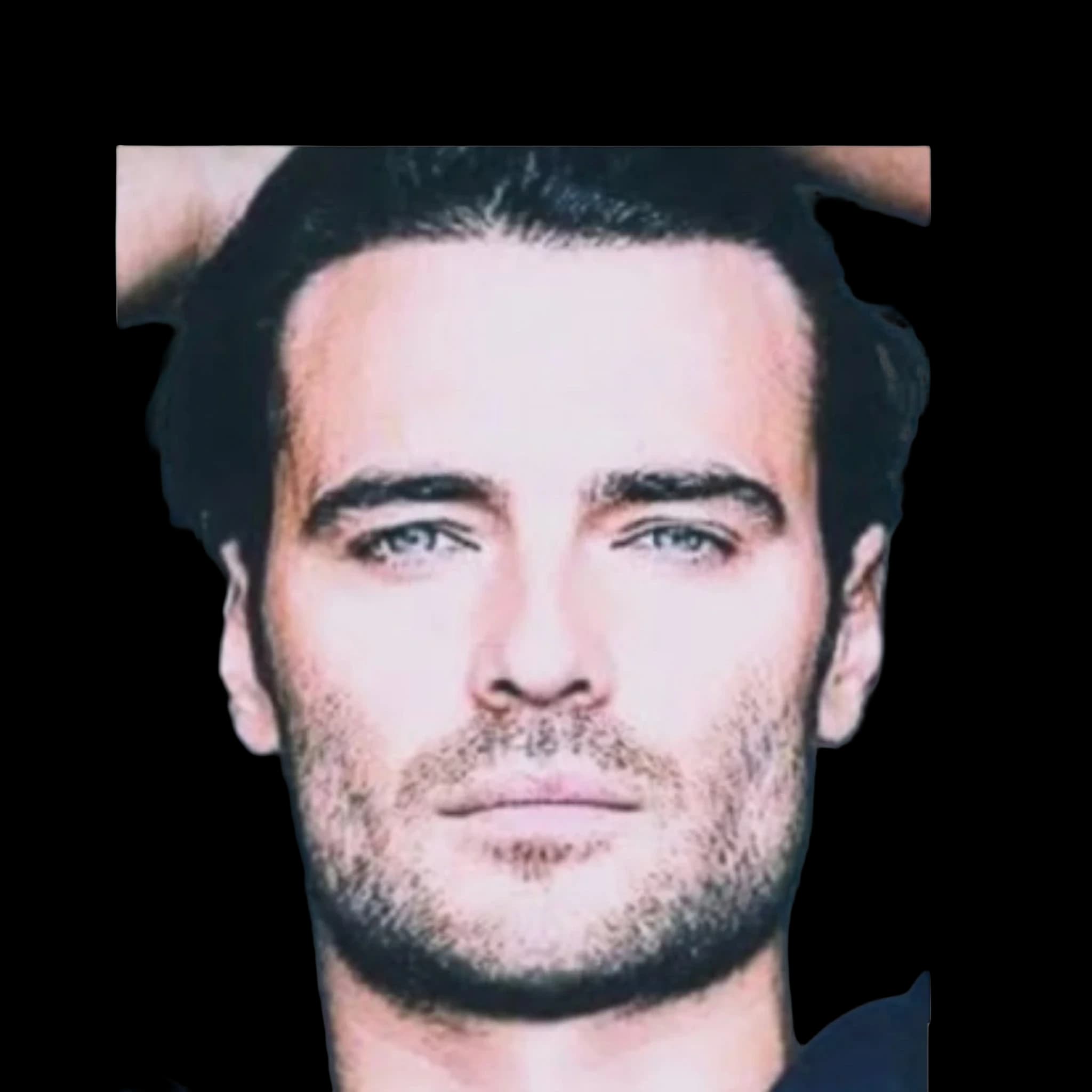 Giulio Berruti, Hyperpigmentation