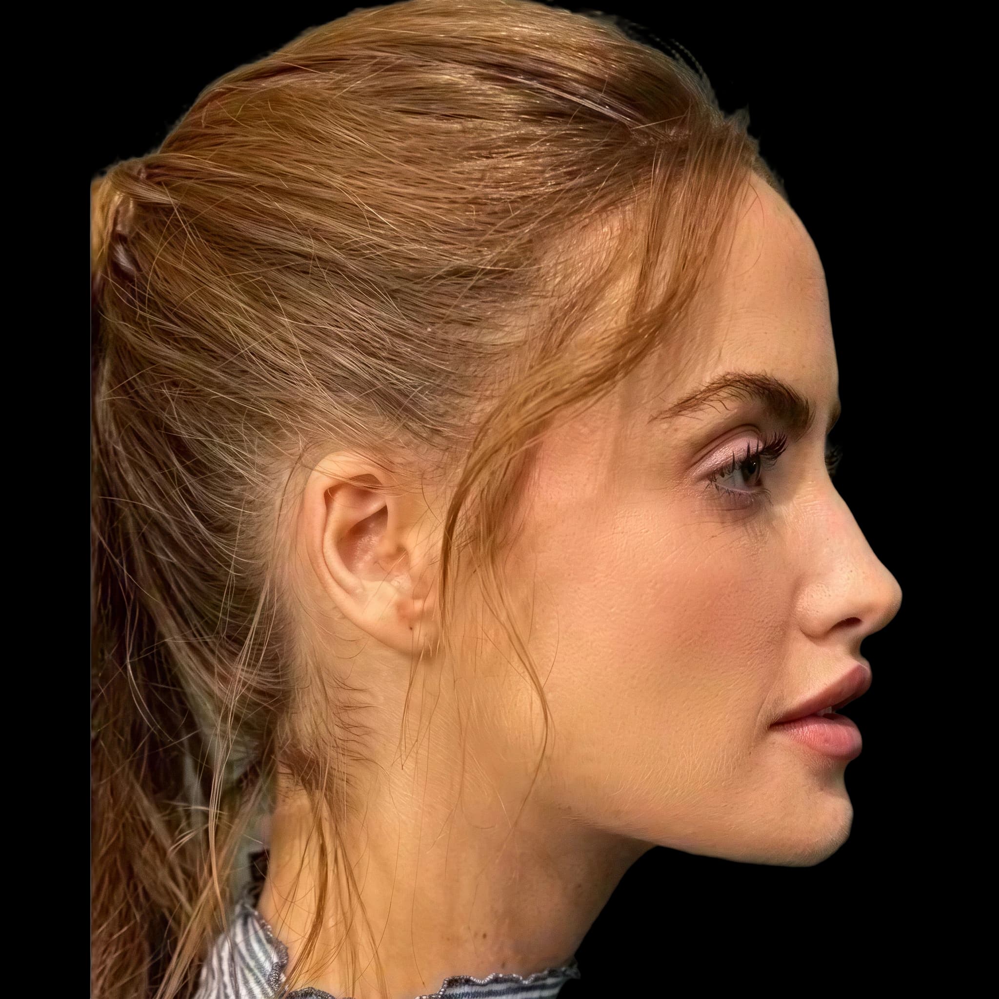 Haley Kalil, Nasal Projection