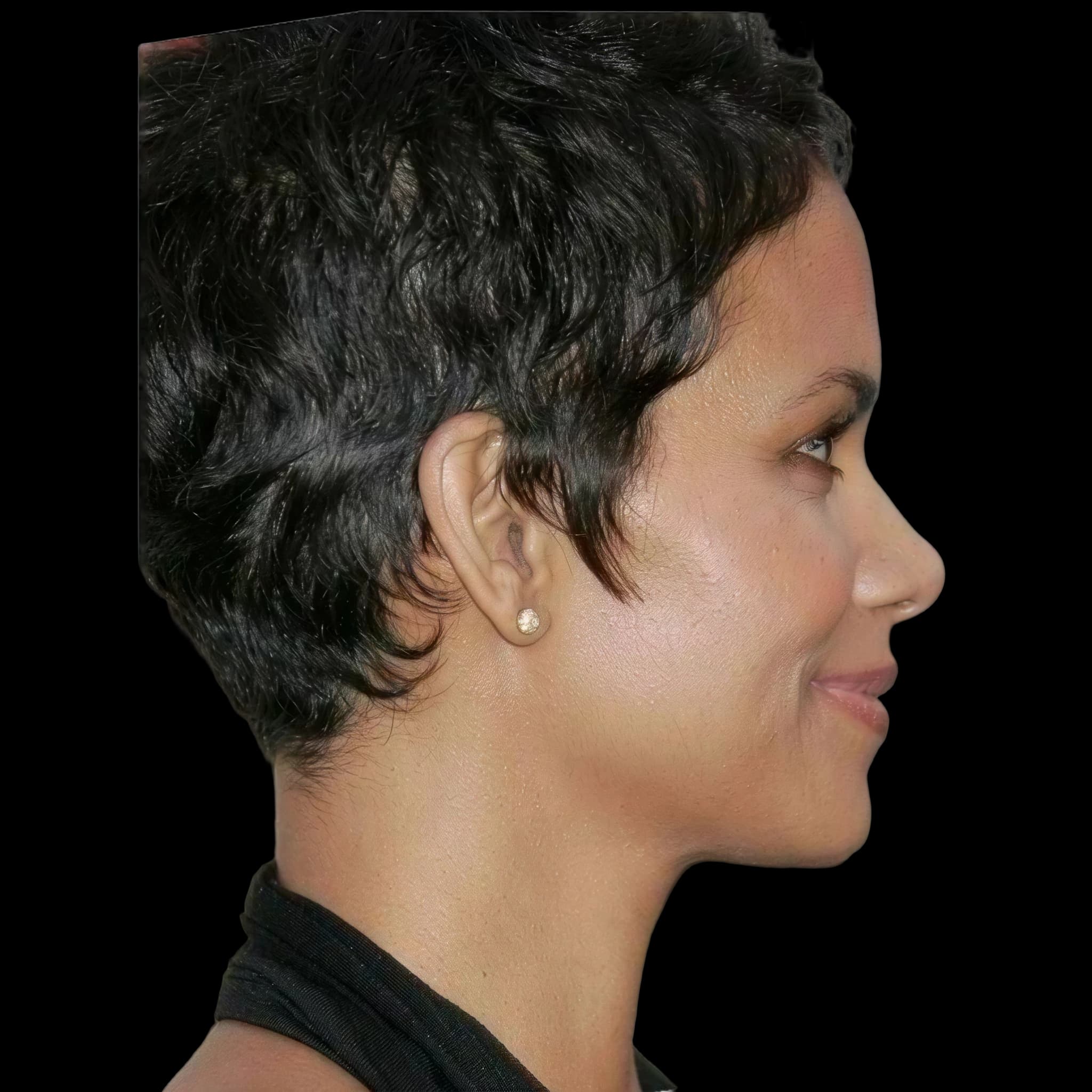 Halle Berry, Mandibular Plane Angle