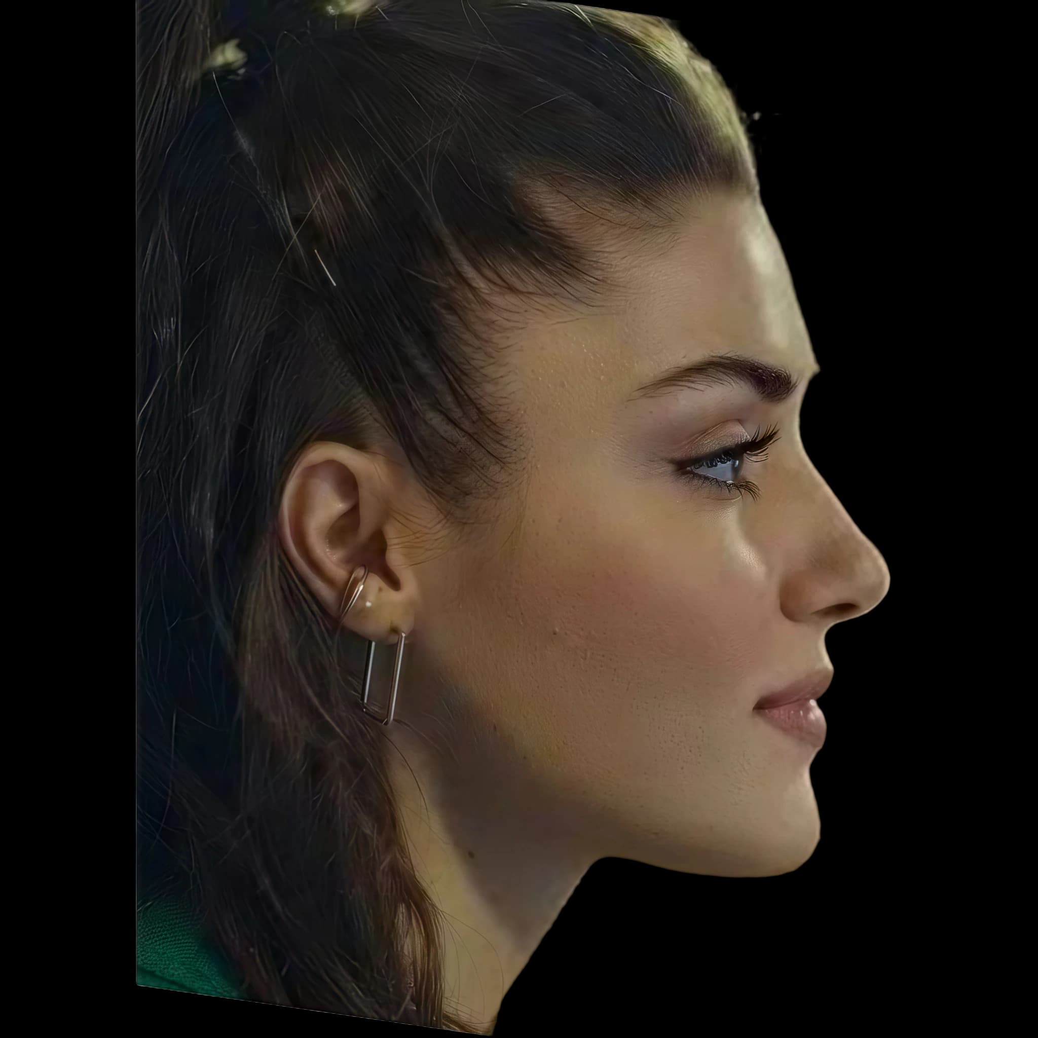 Hande Erçel, Eye Protrusion