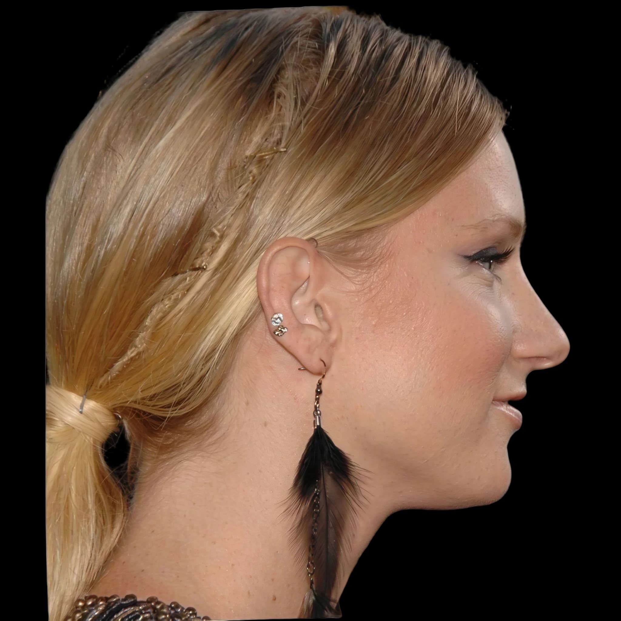 Heather Morris, Submental Definition