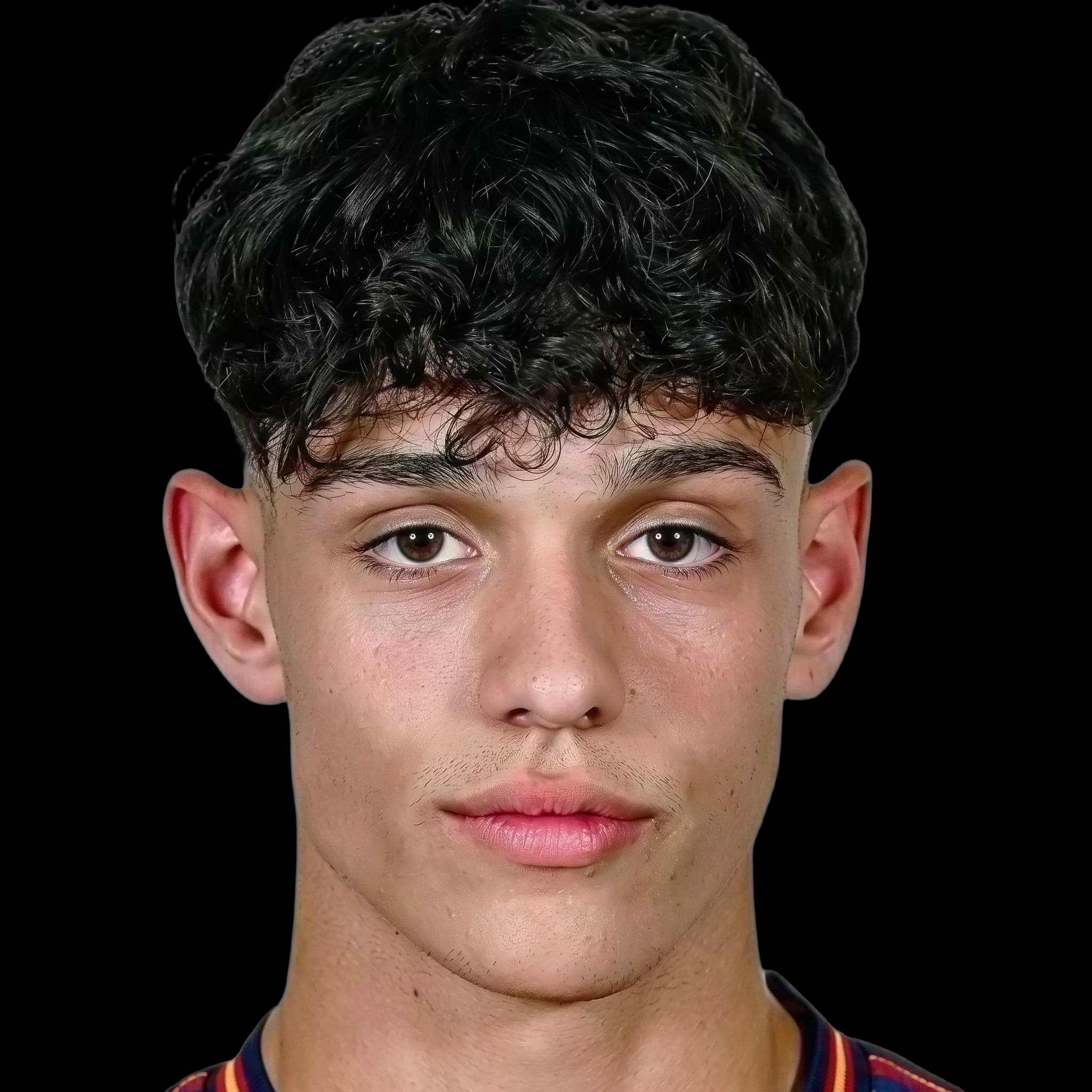 Héctor Fort, Hyperpigmentation
