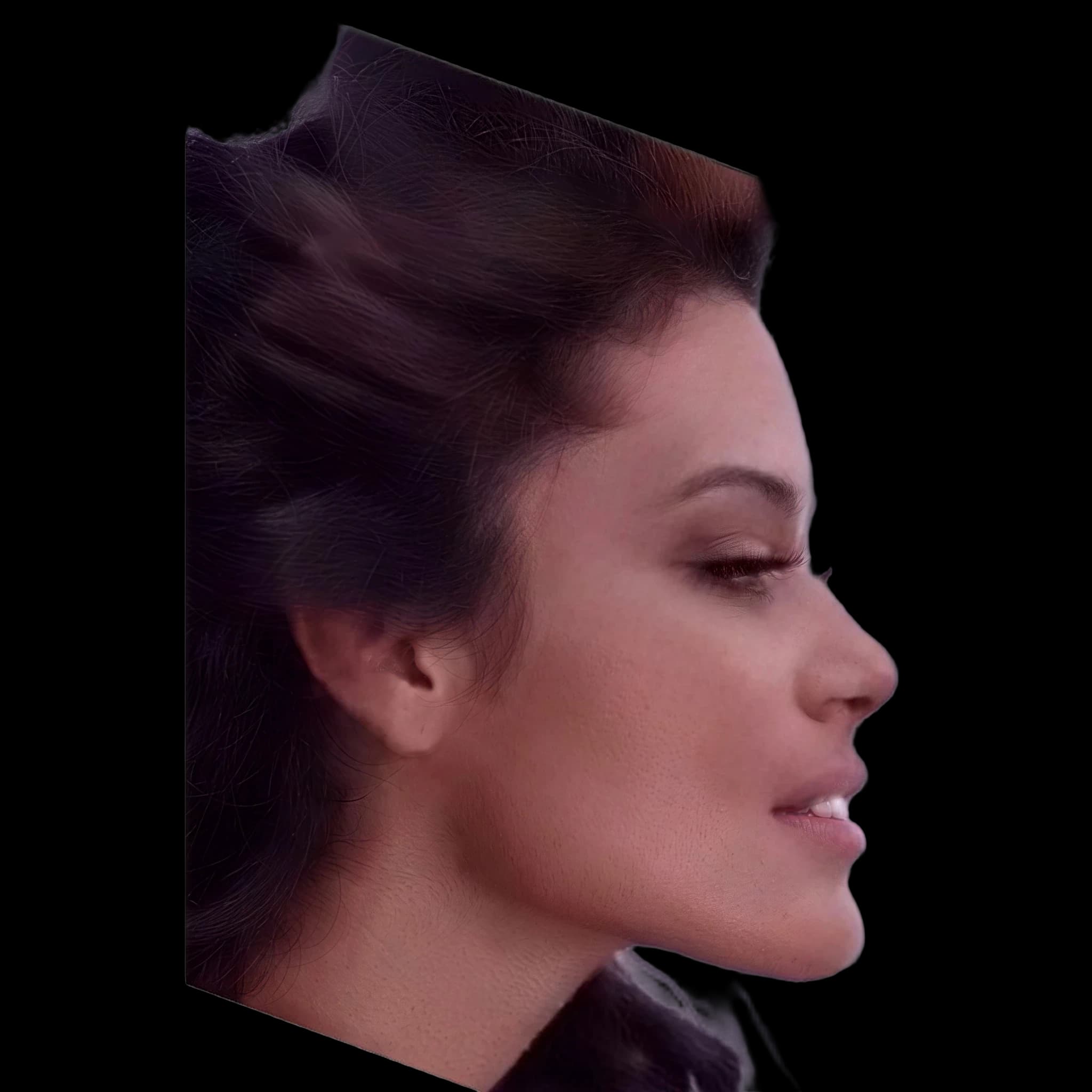 Ildi Silva, Nasomental Angle