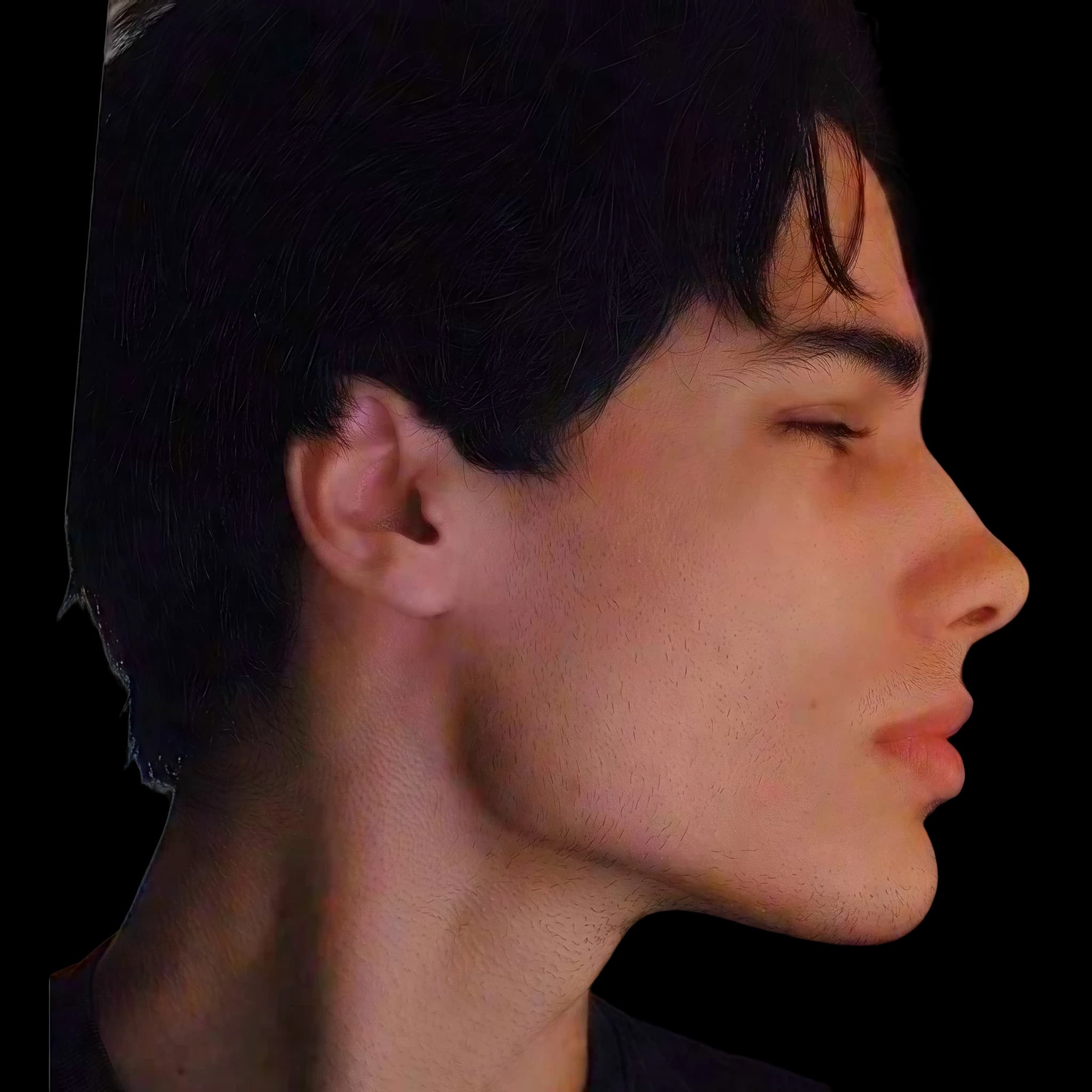 Imad Skywalker, Submental Definition