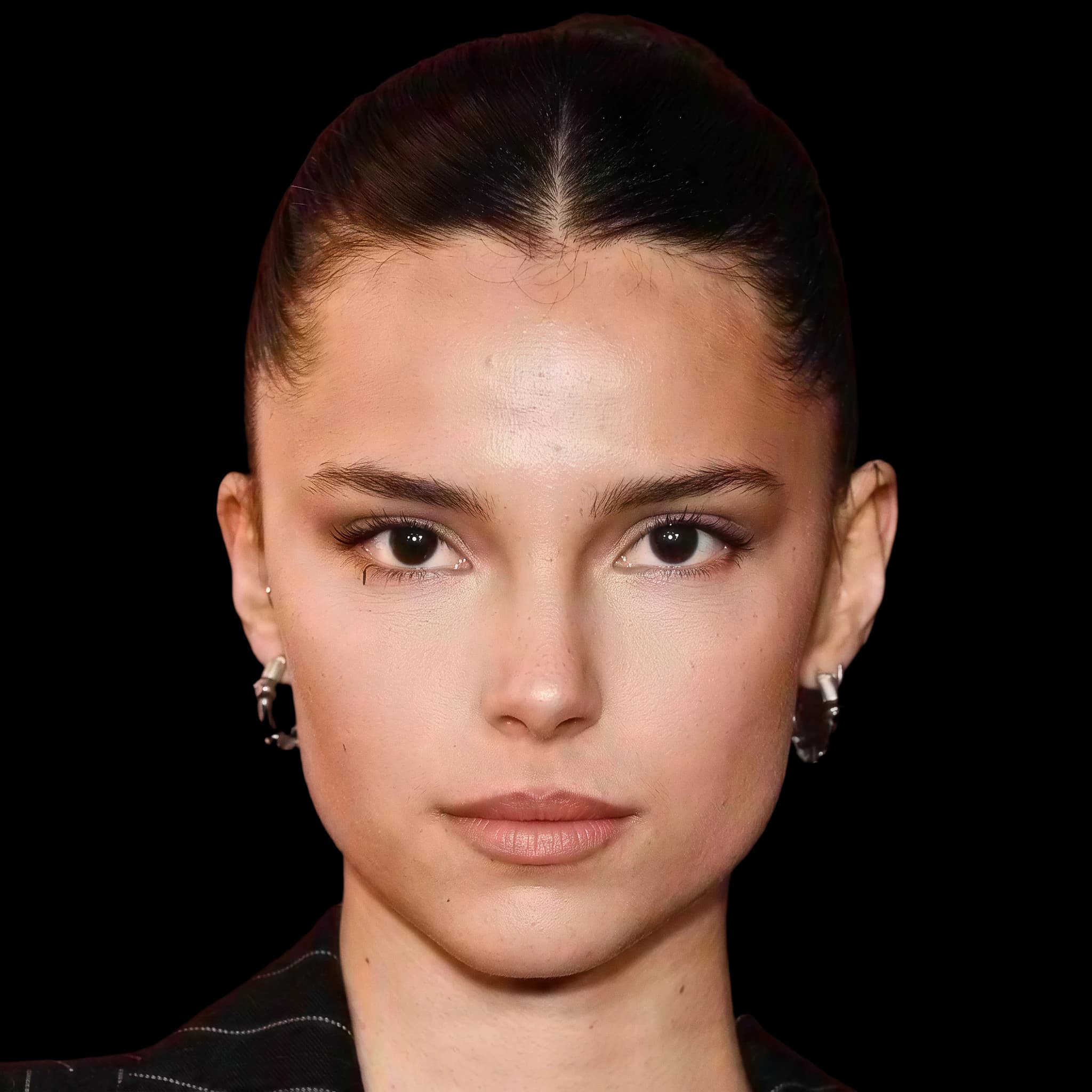Inde Navarrette, Hyperpigmentation