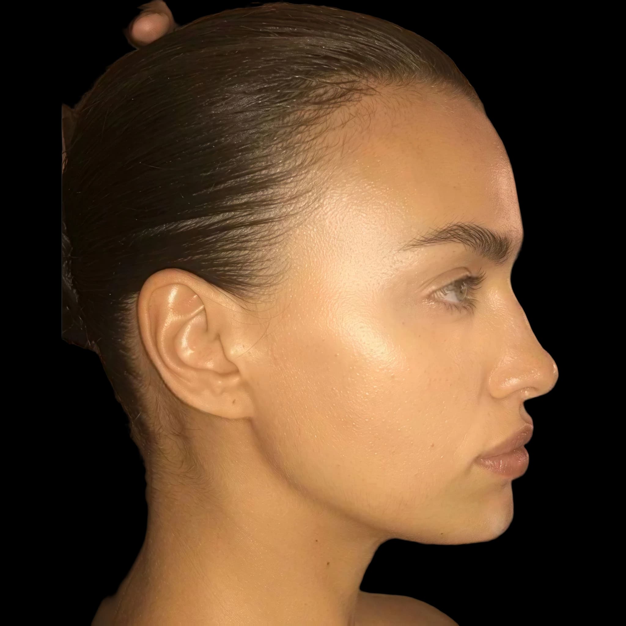 Irina Shayk, Gonial Angle