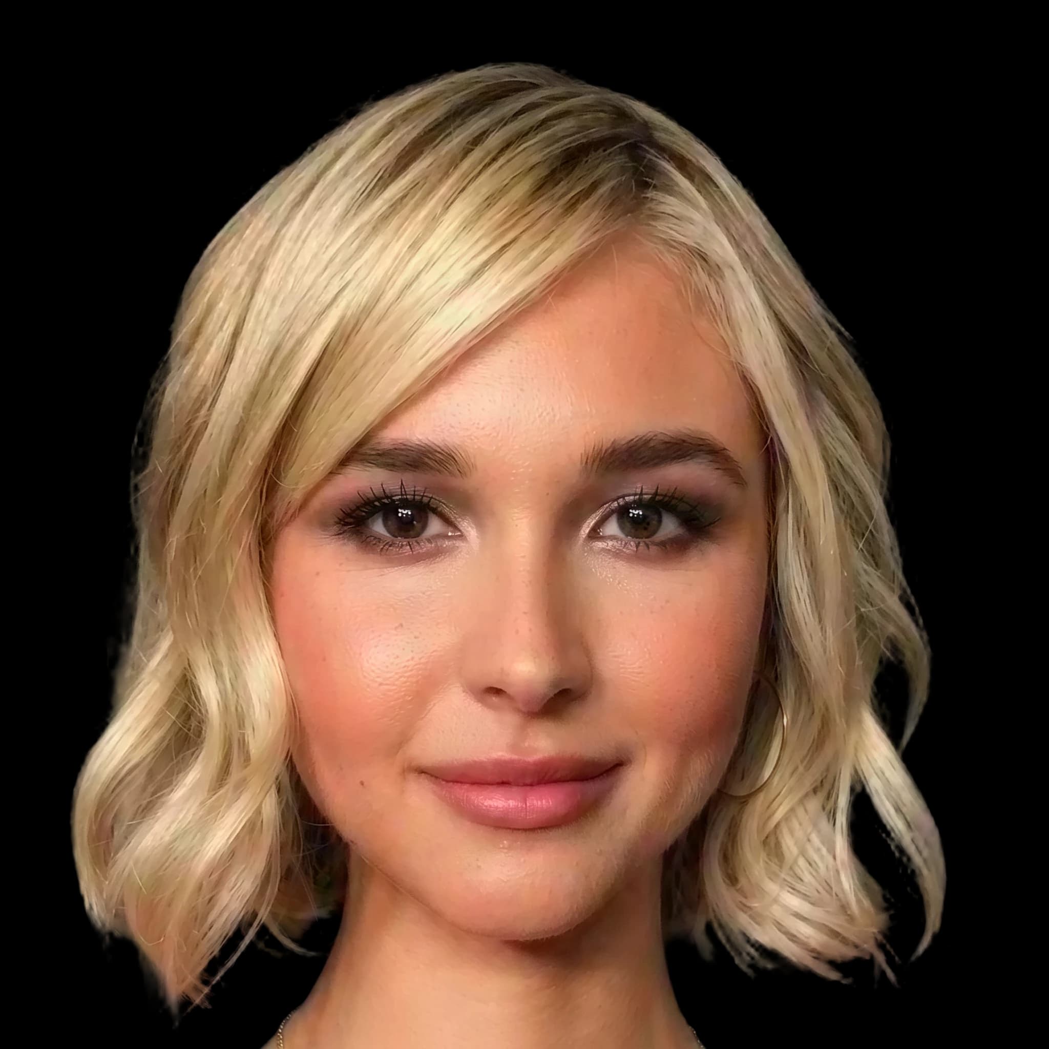 Isobel May, Hyperpigmentation