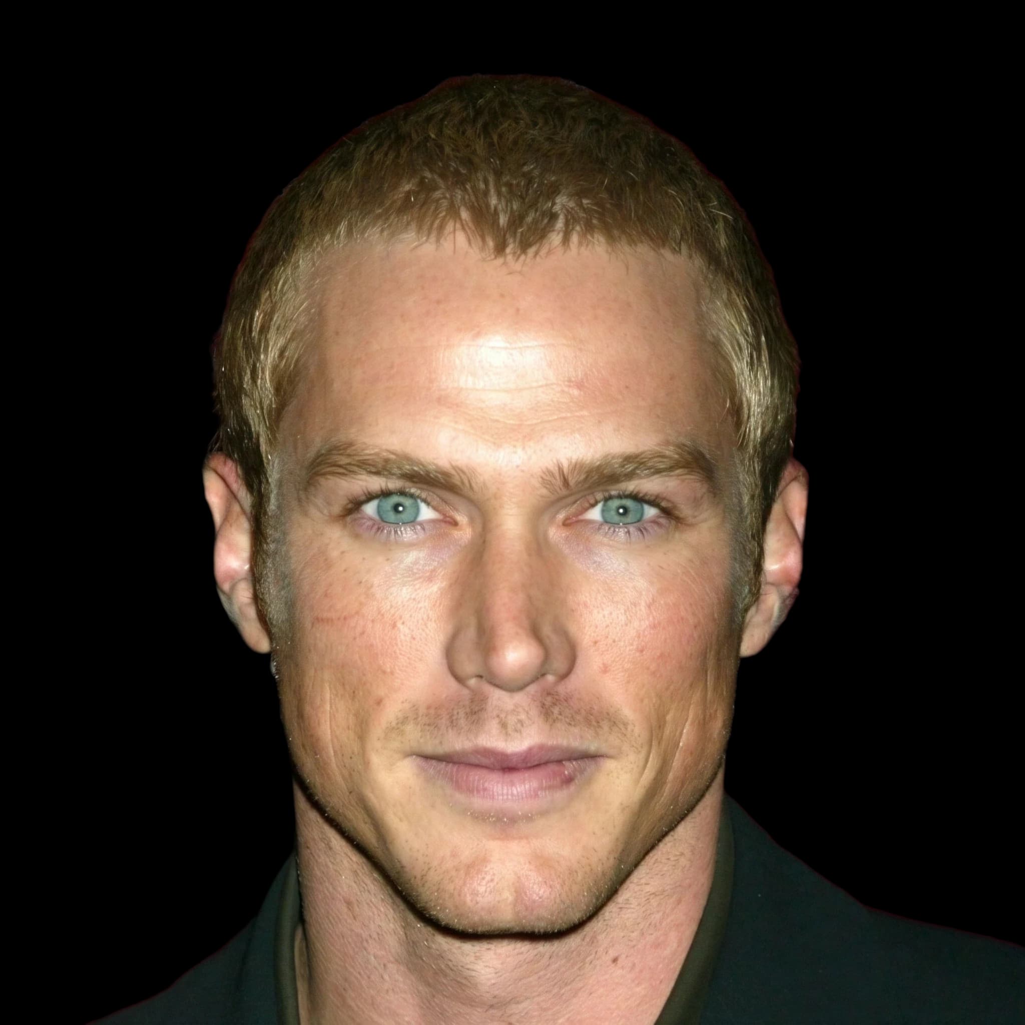 Jason Lewis, Hyperpigmentation