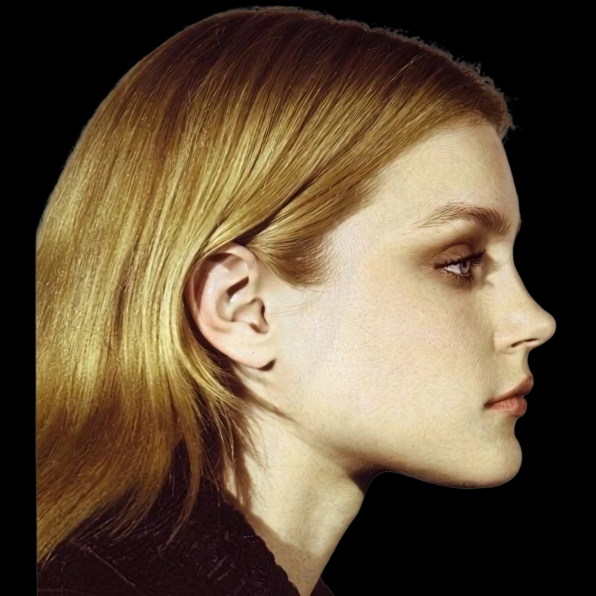 Jessica Stam, Submental Definition