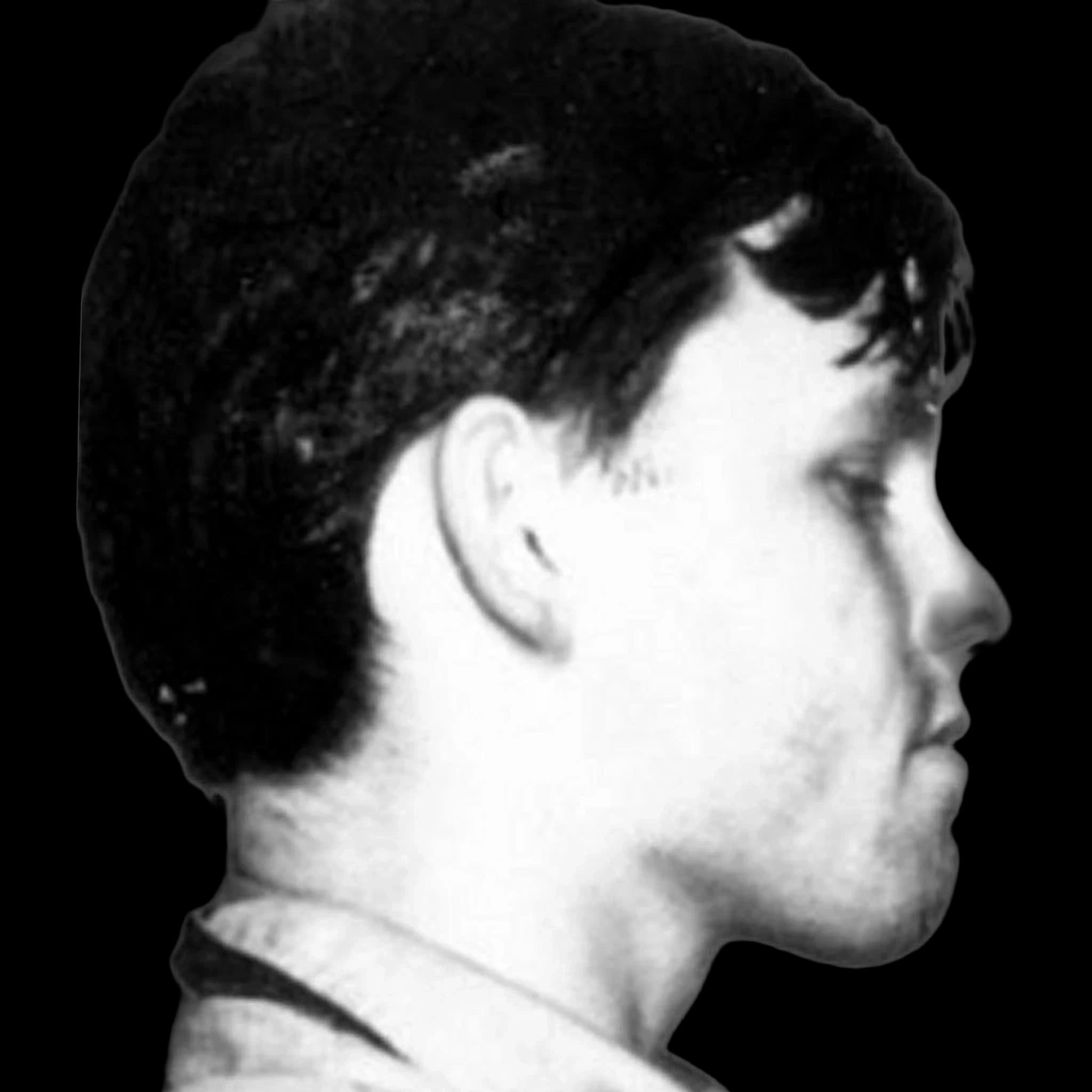 Jim Morrison, Nasal Tip Angle