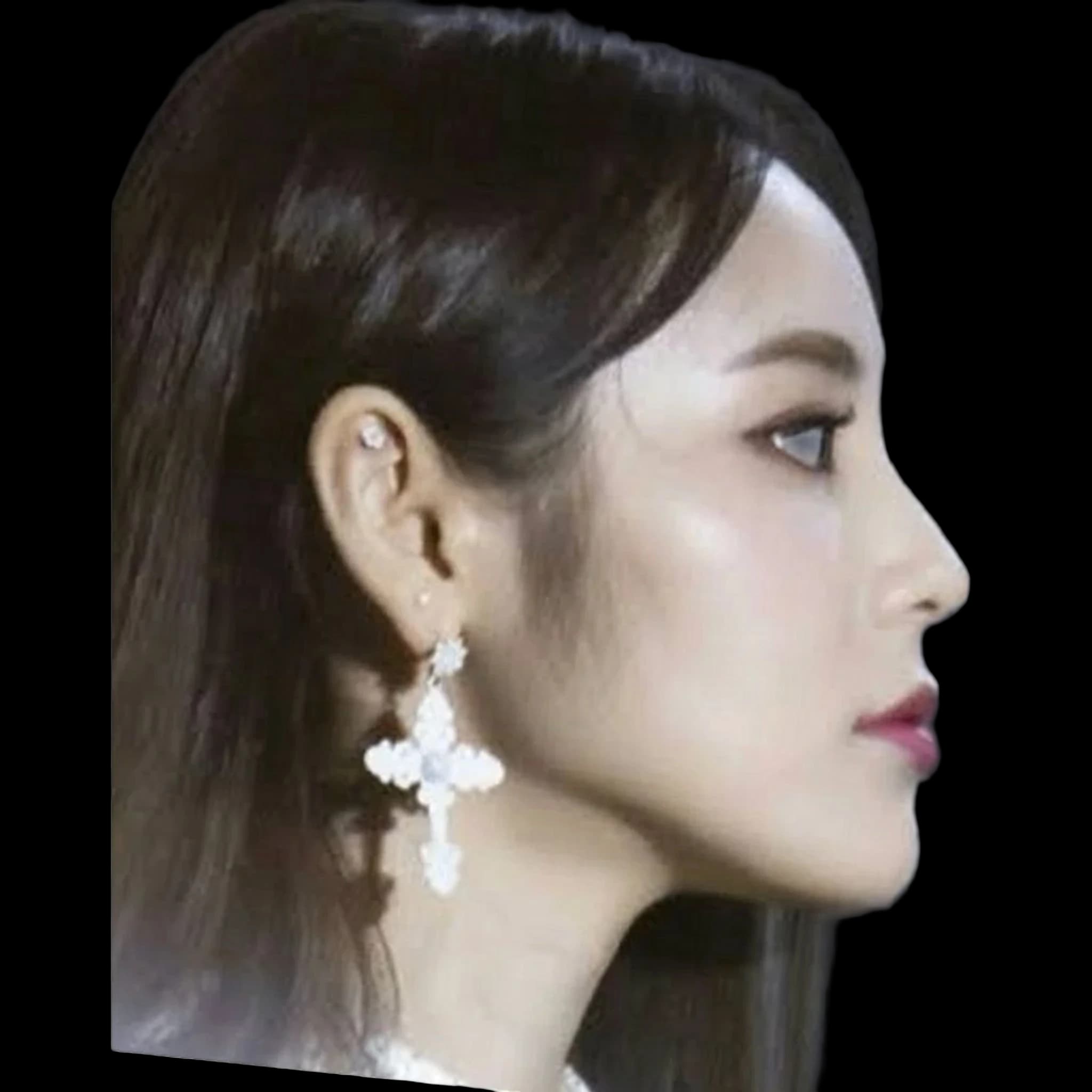 Jinsoul (ARTMS), Submental Definition