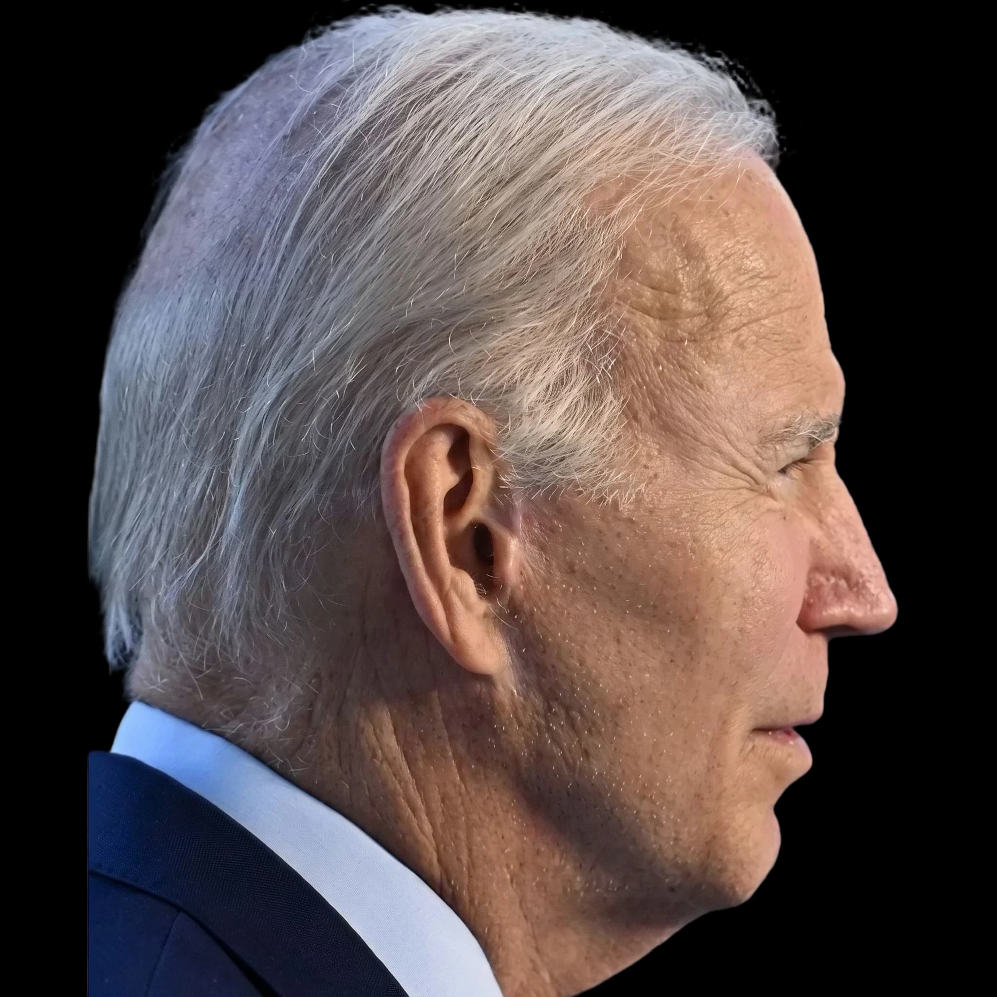 Joe Biden, Mandibular Plane Angle