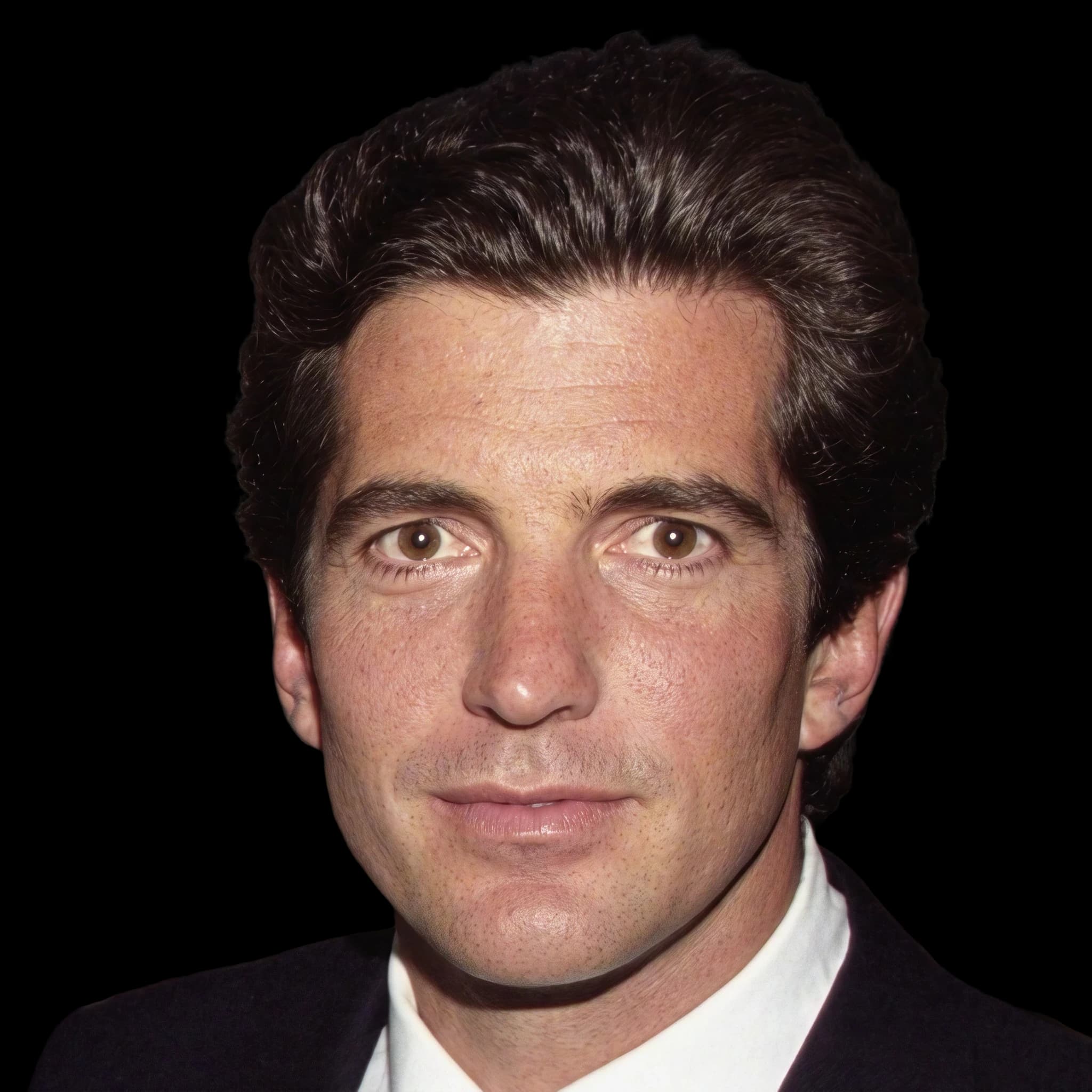 John F. Kennedy Jr., Hyperpigmentation
