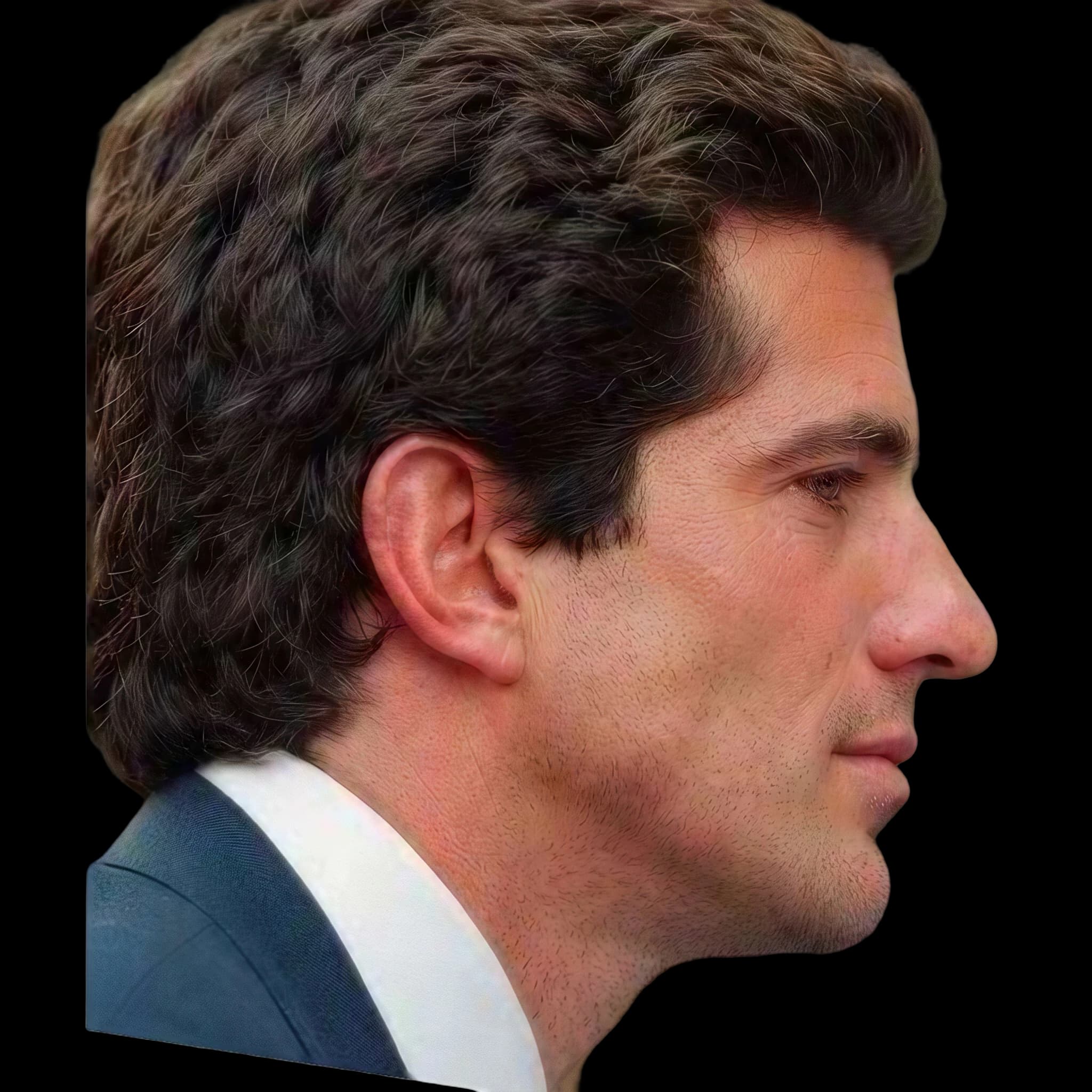 John F. Kennedy Jr., Nasofrontal Angle