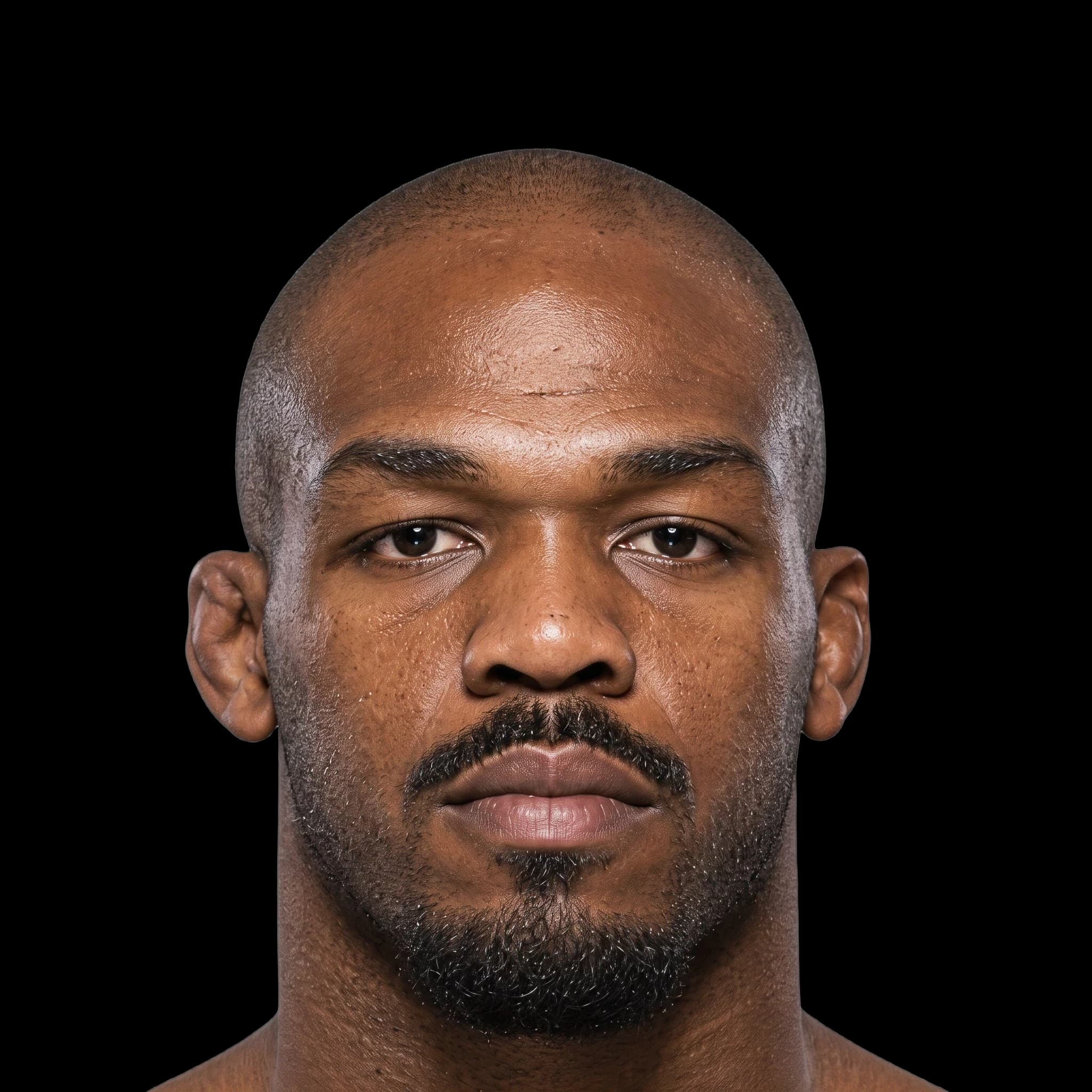 Jon Jones, Hyperpigmentation