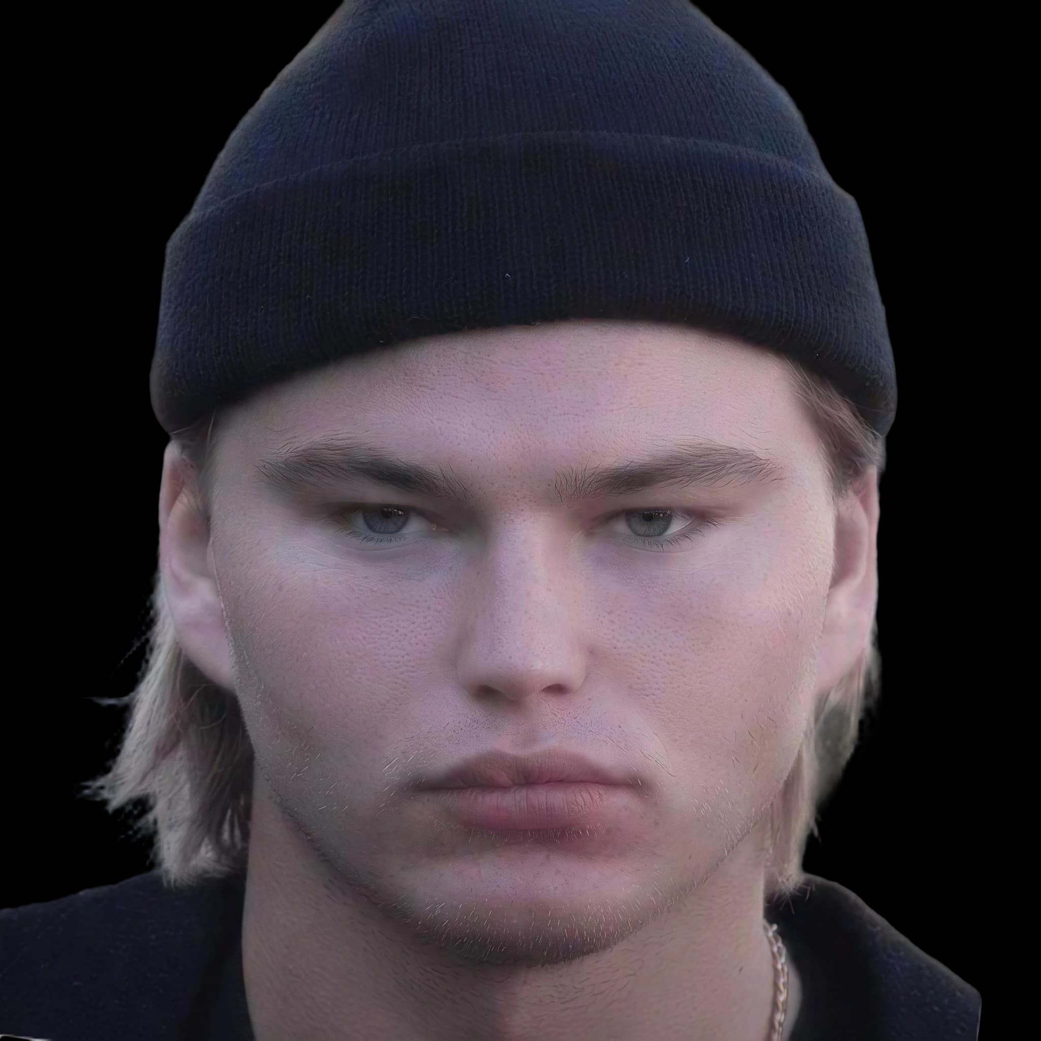 Jordan Barrett (debloated), Lower Lip to Upper Lip Ratio