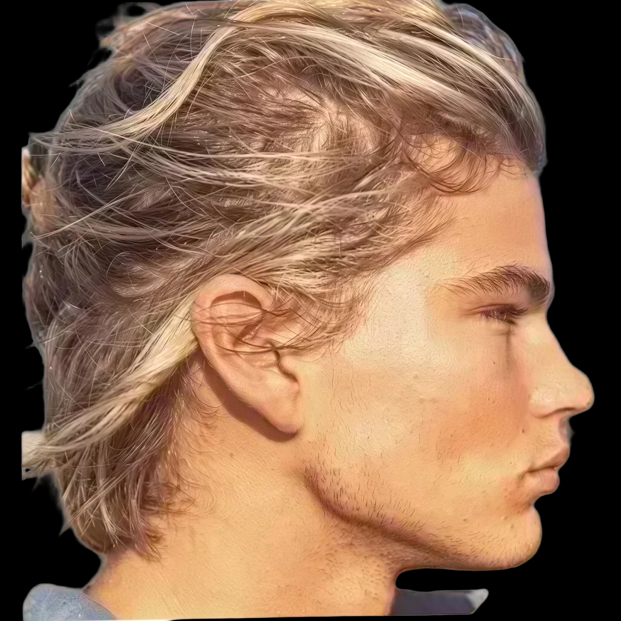 Jordan Barrett (debloated), Mandibular Plane Angle