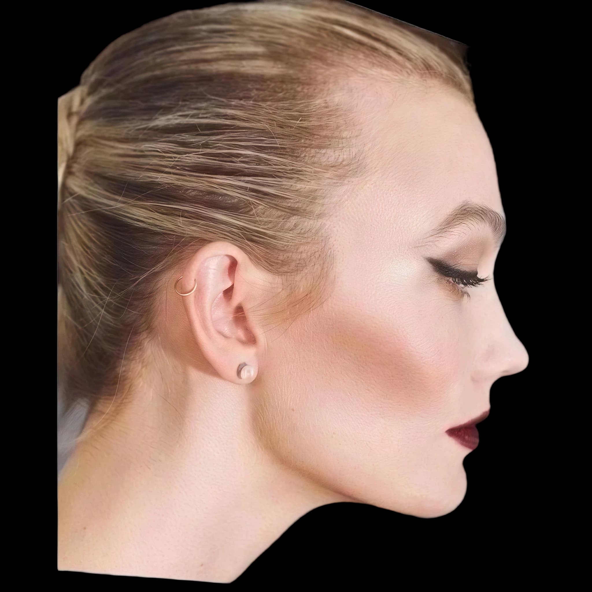 Karlie Kloss, Submental Definition