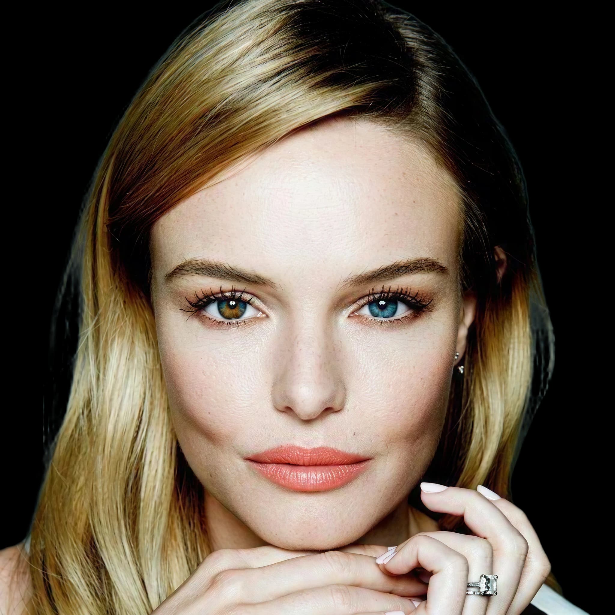 Kate Bosworth, Hyperpigmentation