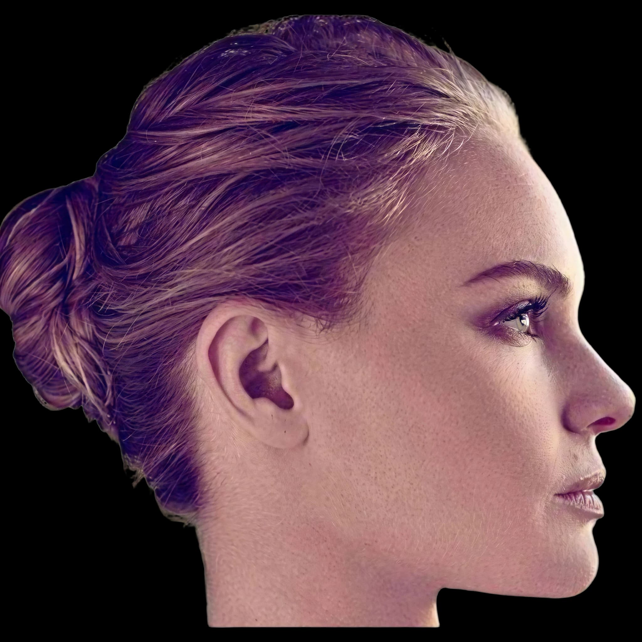 Kate Bosworth, Upper Lip E-Line Position
