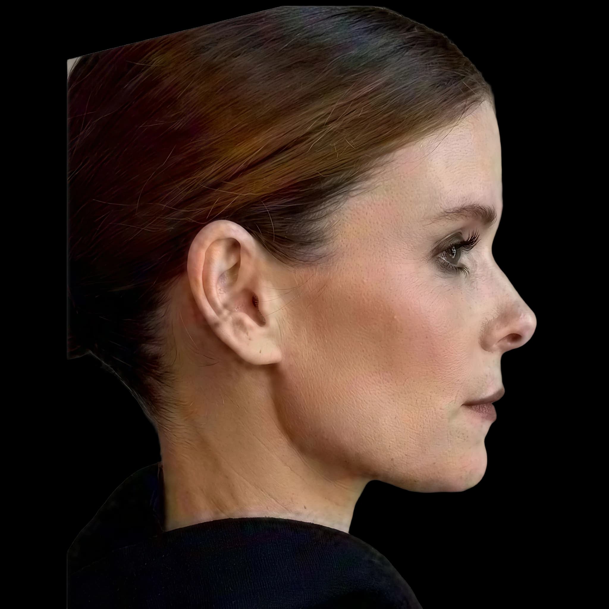 Kate Mara, Nose
