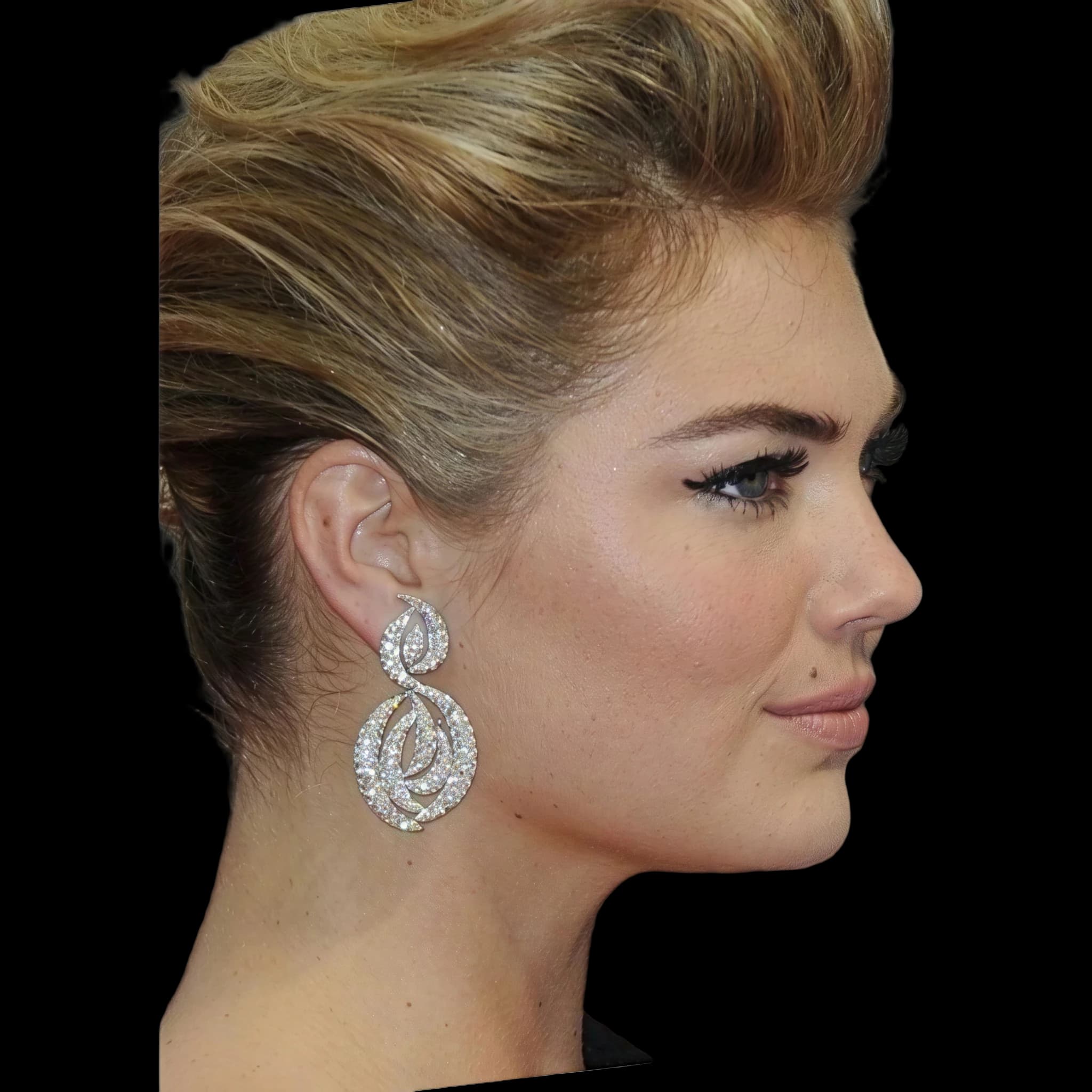 Kate Upton, Lower Lip E-Line Position
