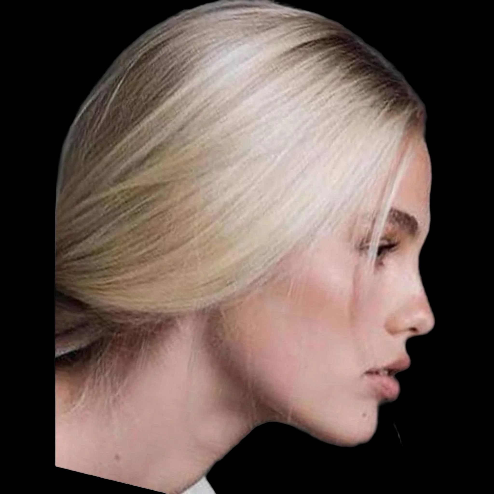 Kathryn Watts, Anterior Facial Depth