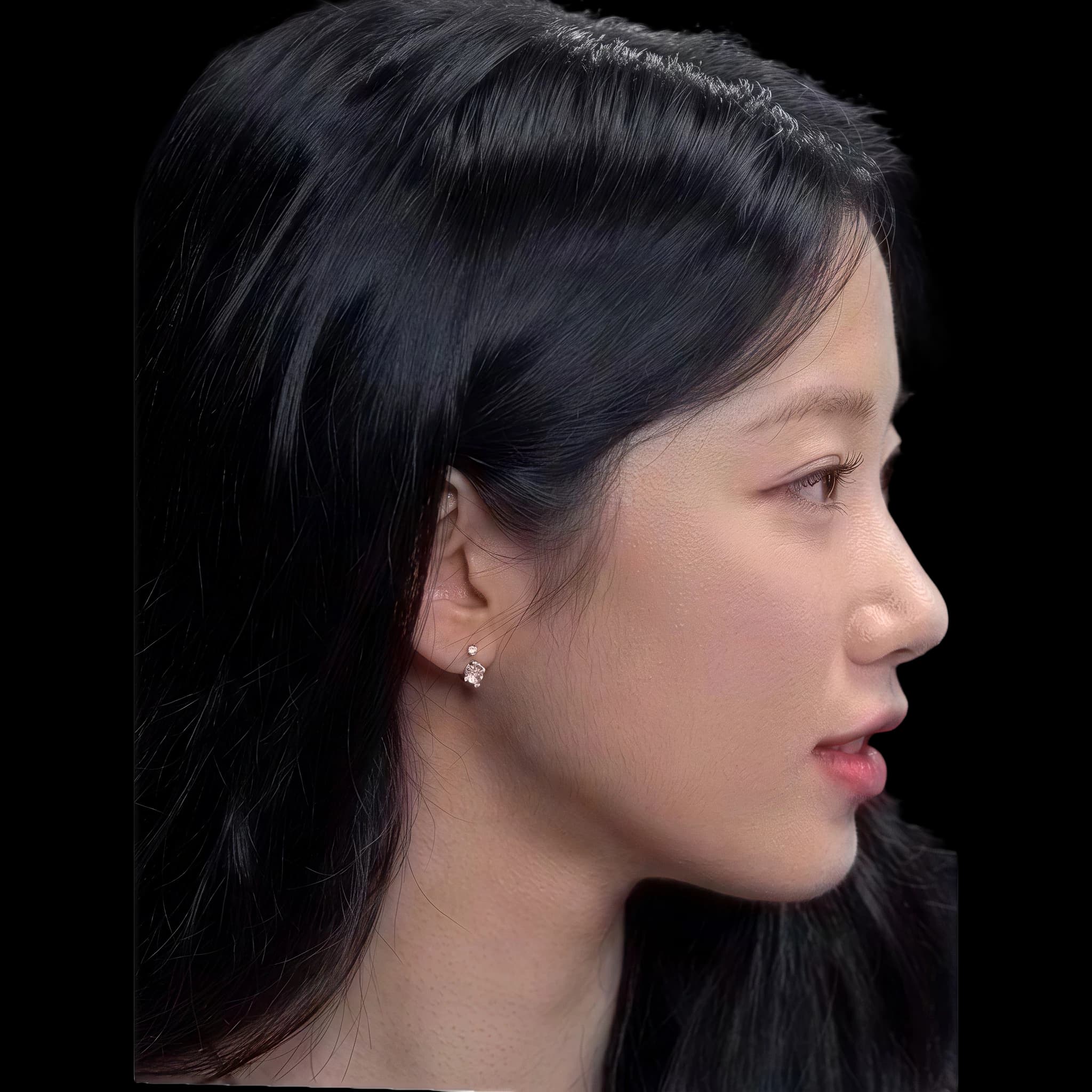 Kazhua, Nasal Tip Angle