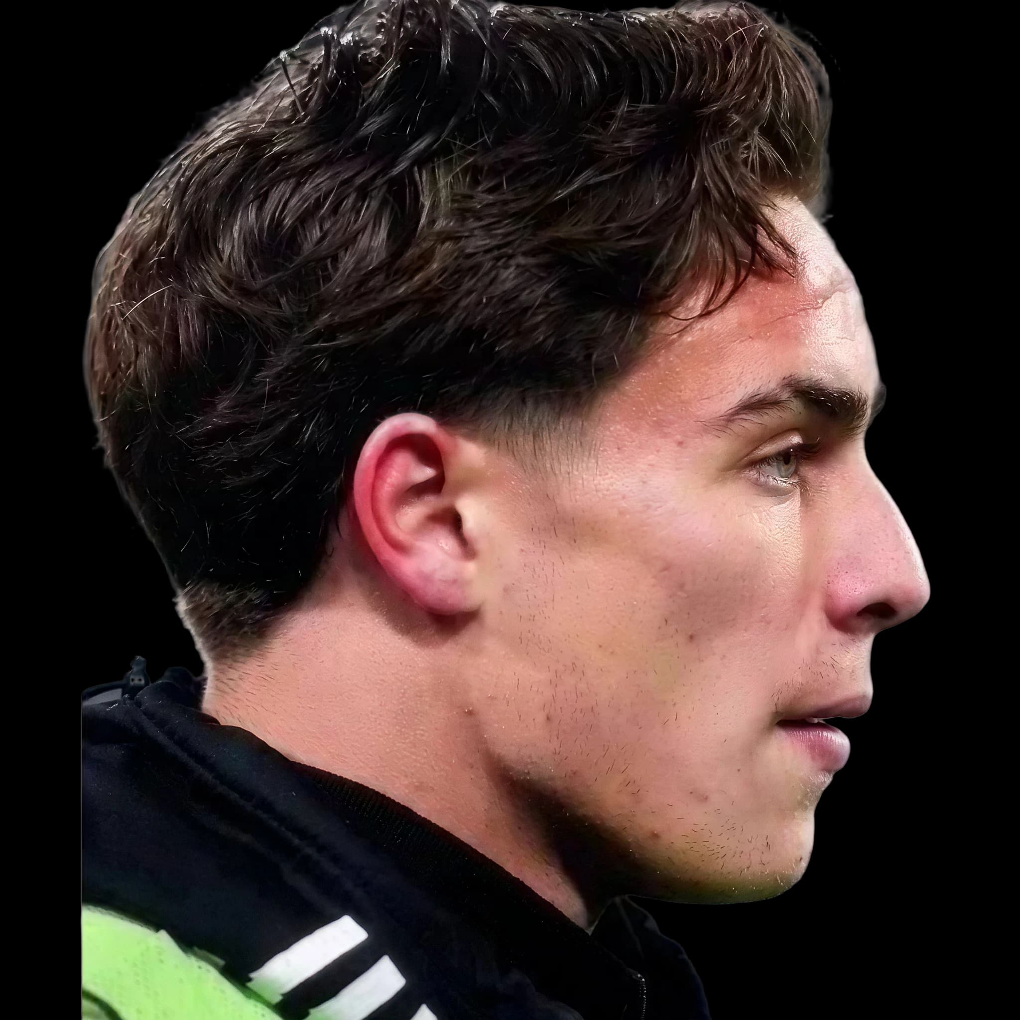 Kenan Yıldız, Submental Definition