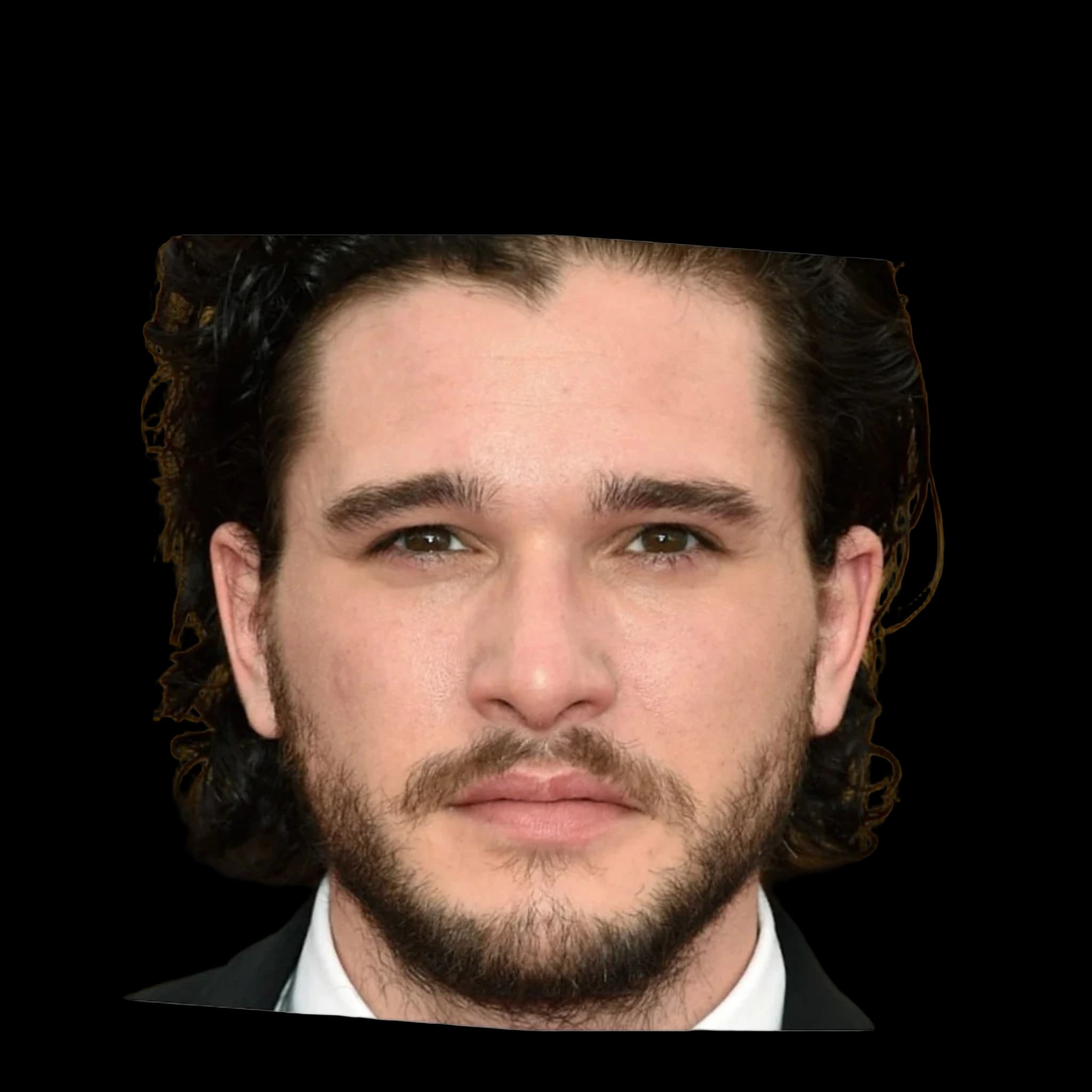 Kit Harrington, Cheekbone Prominence