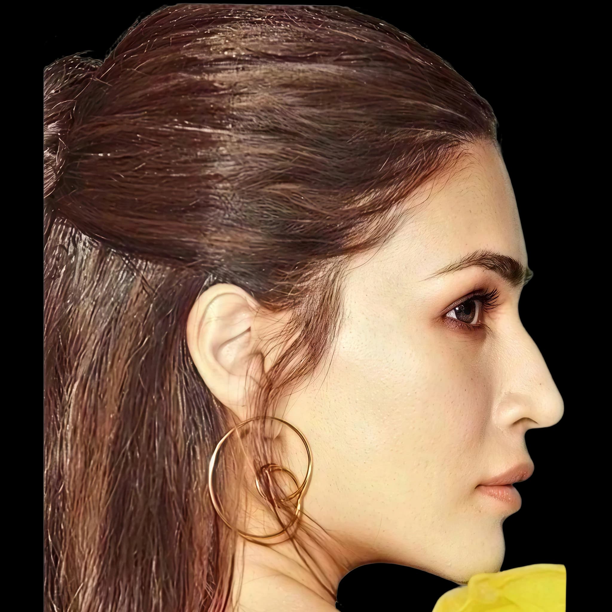 Kriti Sanon, Submental Definition