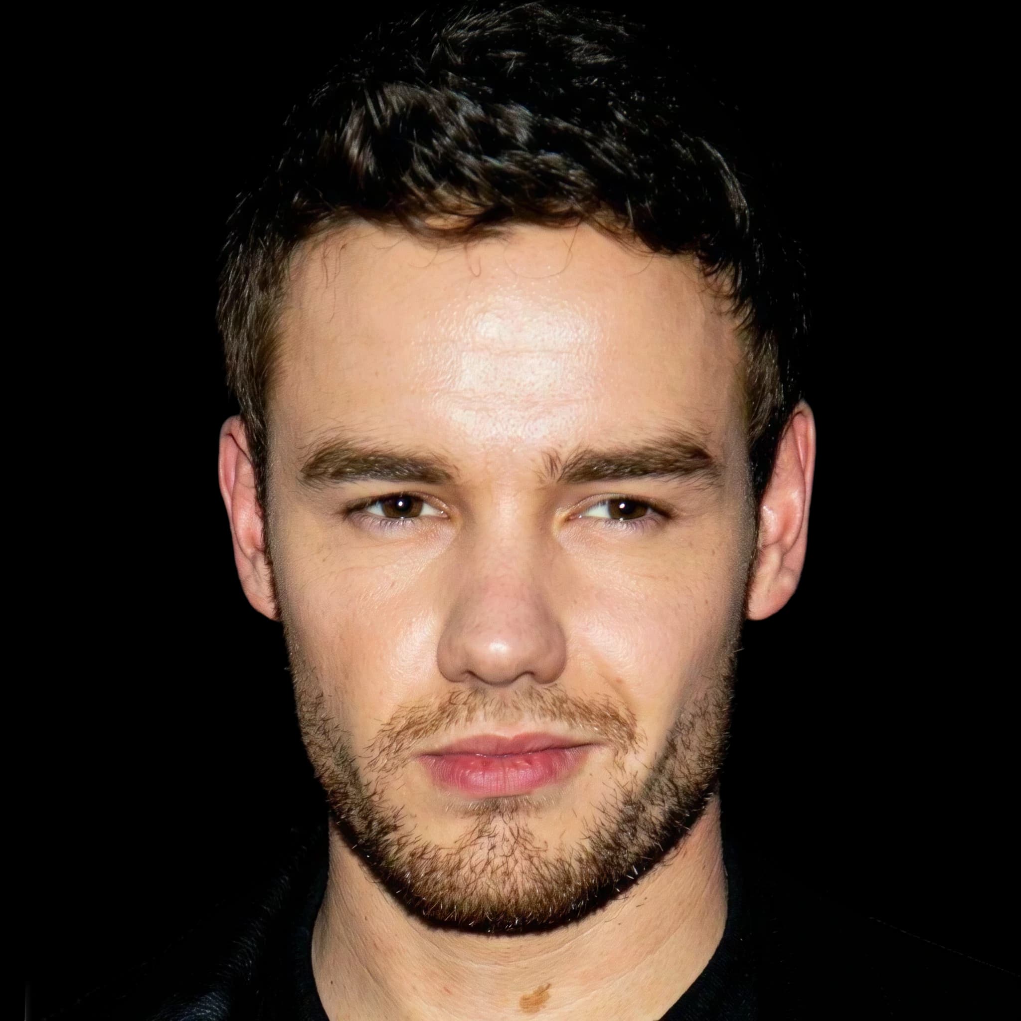 Liam Payne, Cheekbone Prominence