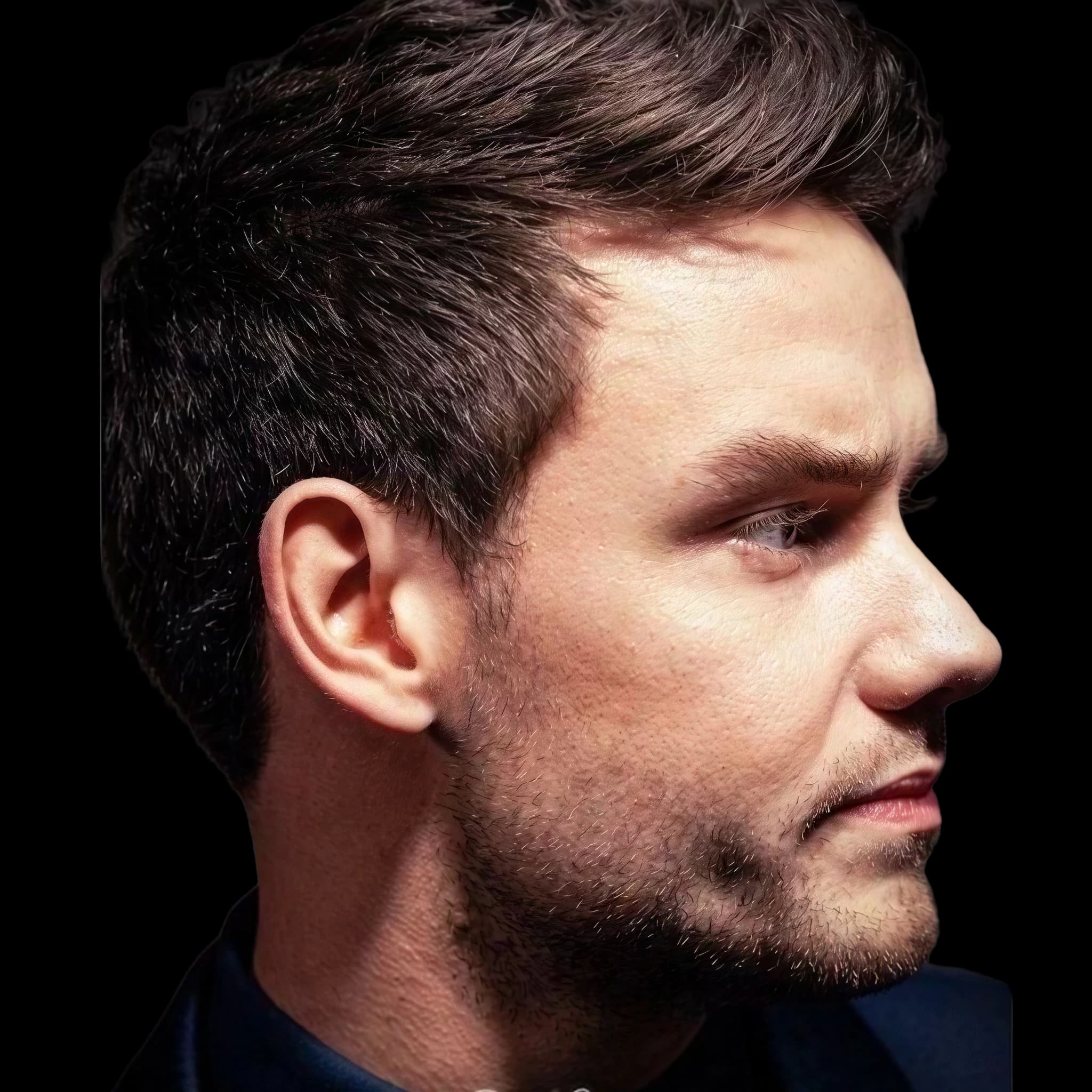 Liam Payne, Submental Definition