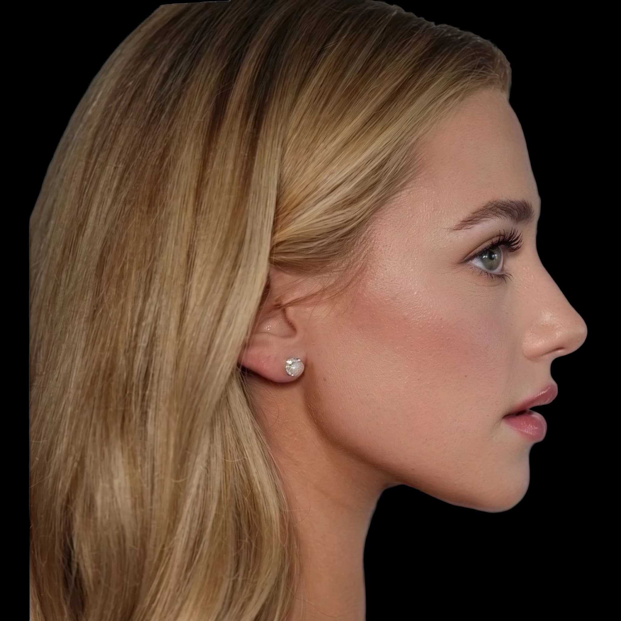 Lili Reinhart, Submental Definition