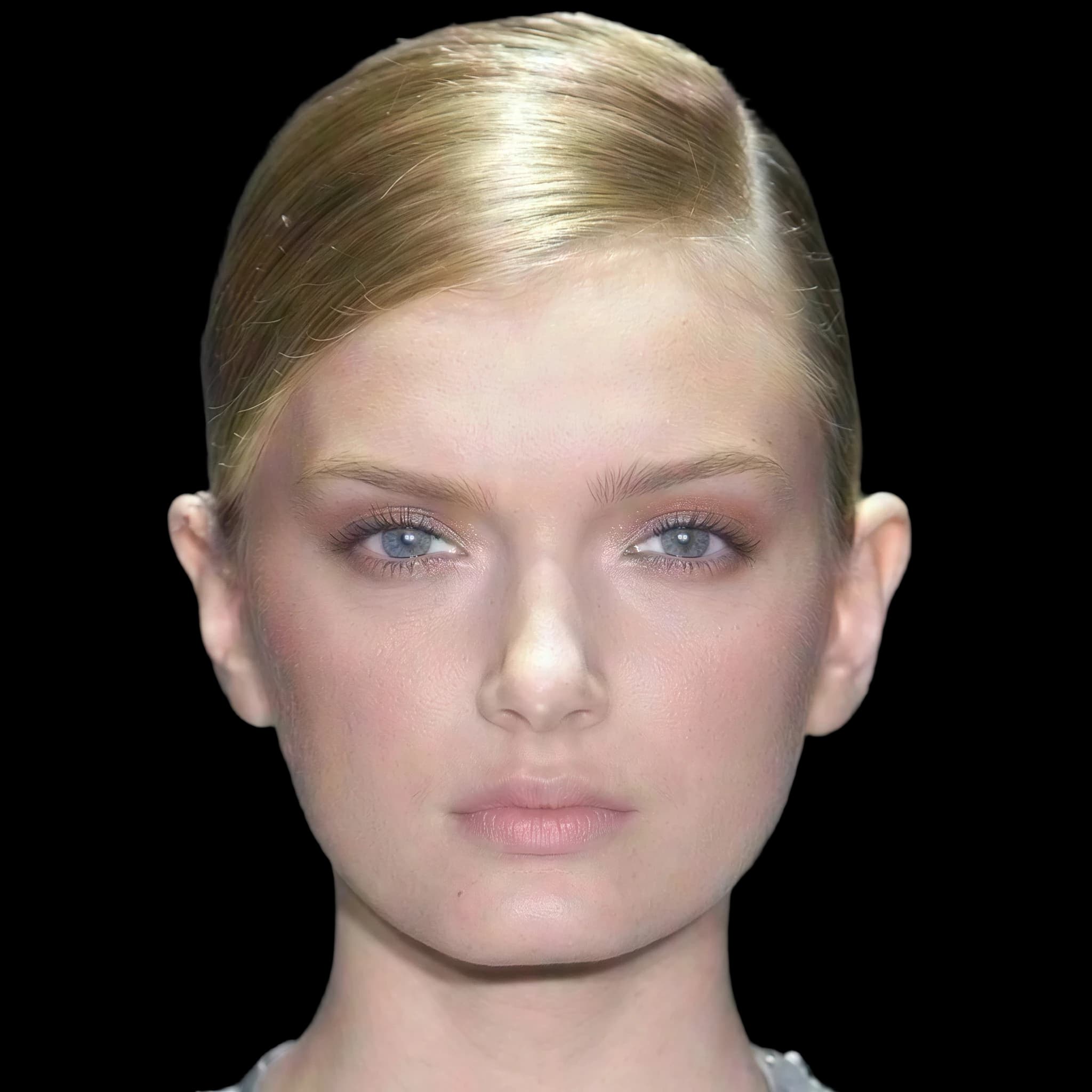 Lily Donaldson, Hypopigmentation