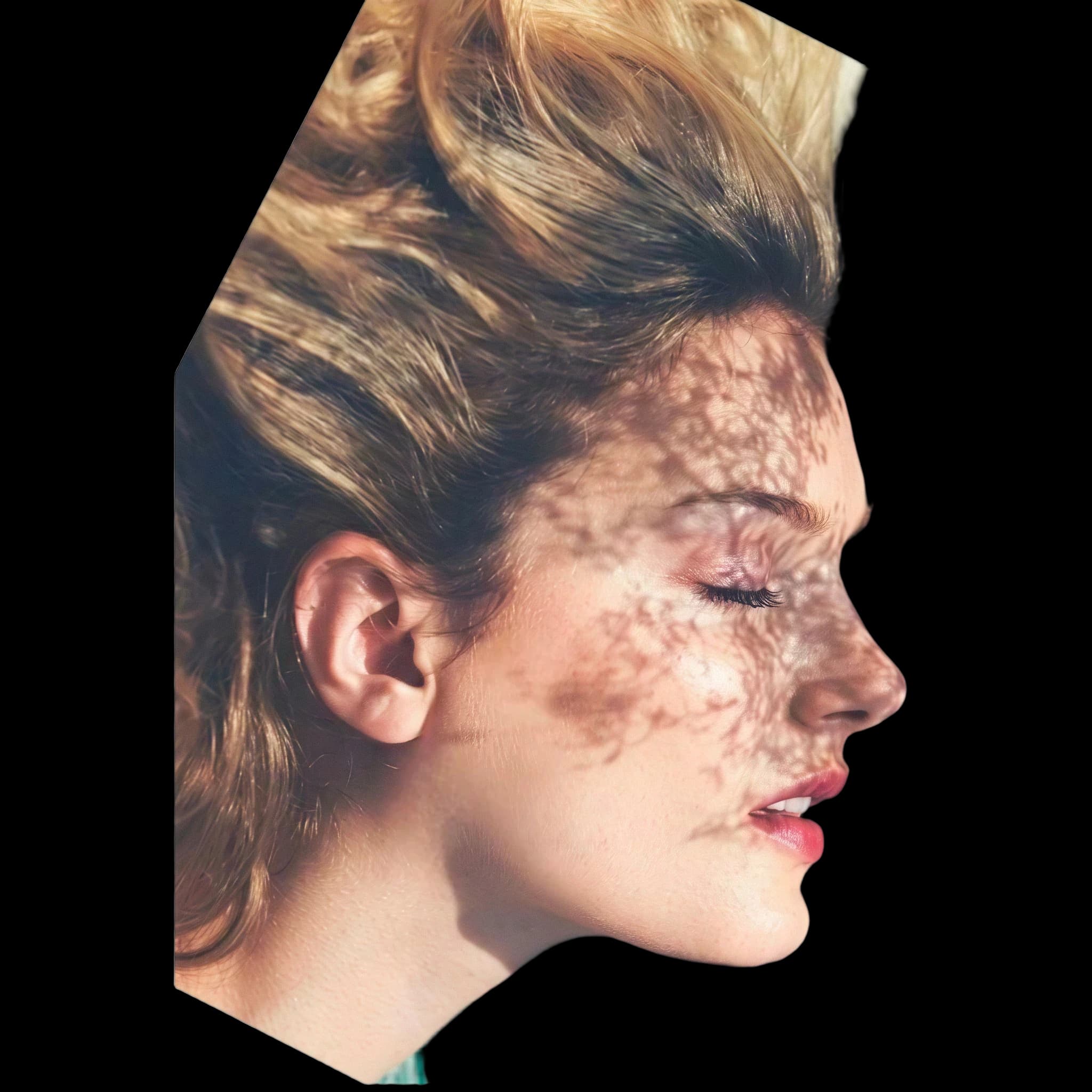 Lily Donaldson, Submental Definition