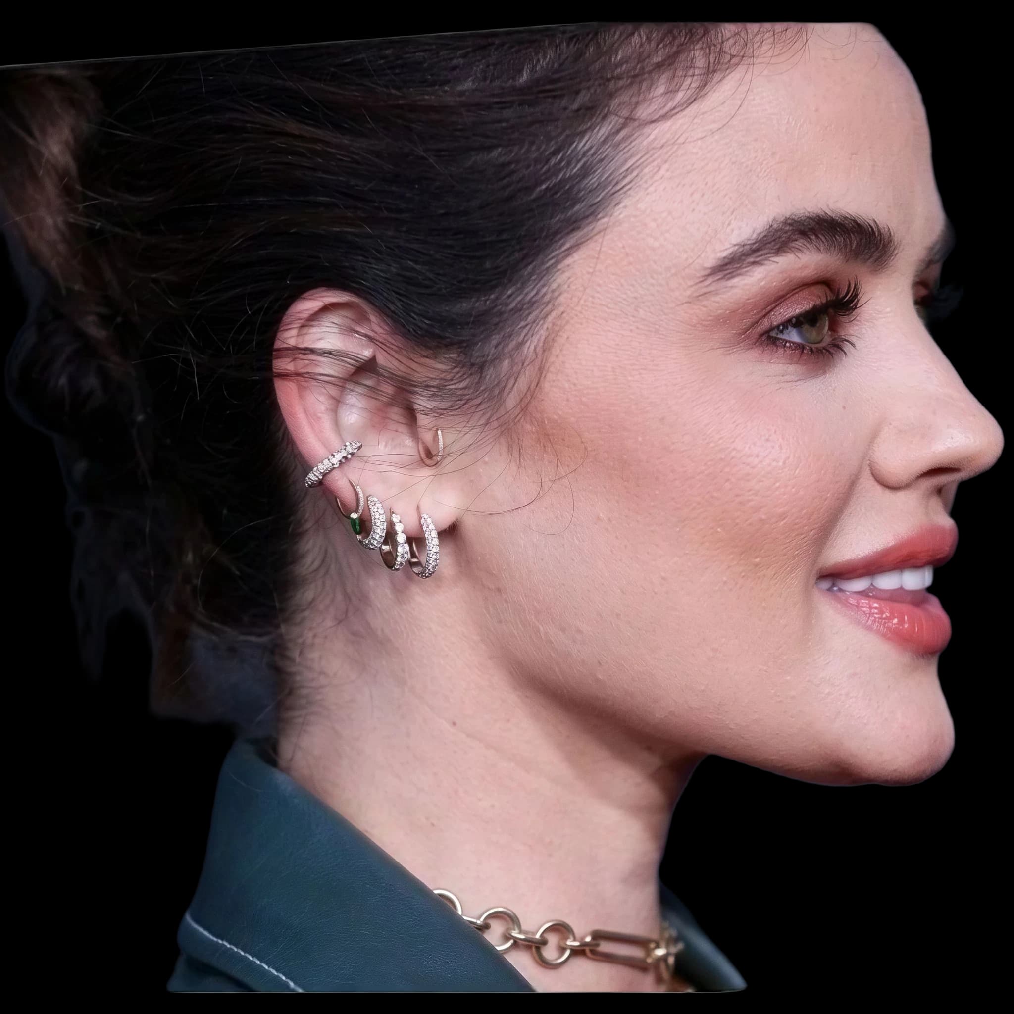 Lucy Hale, Lower Lip E-Line Position