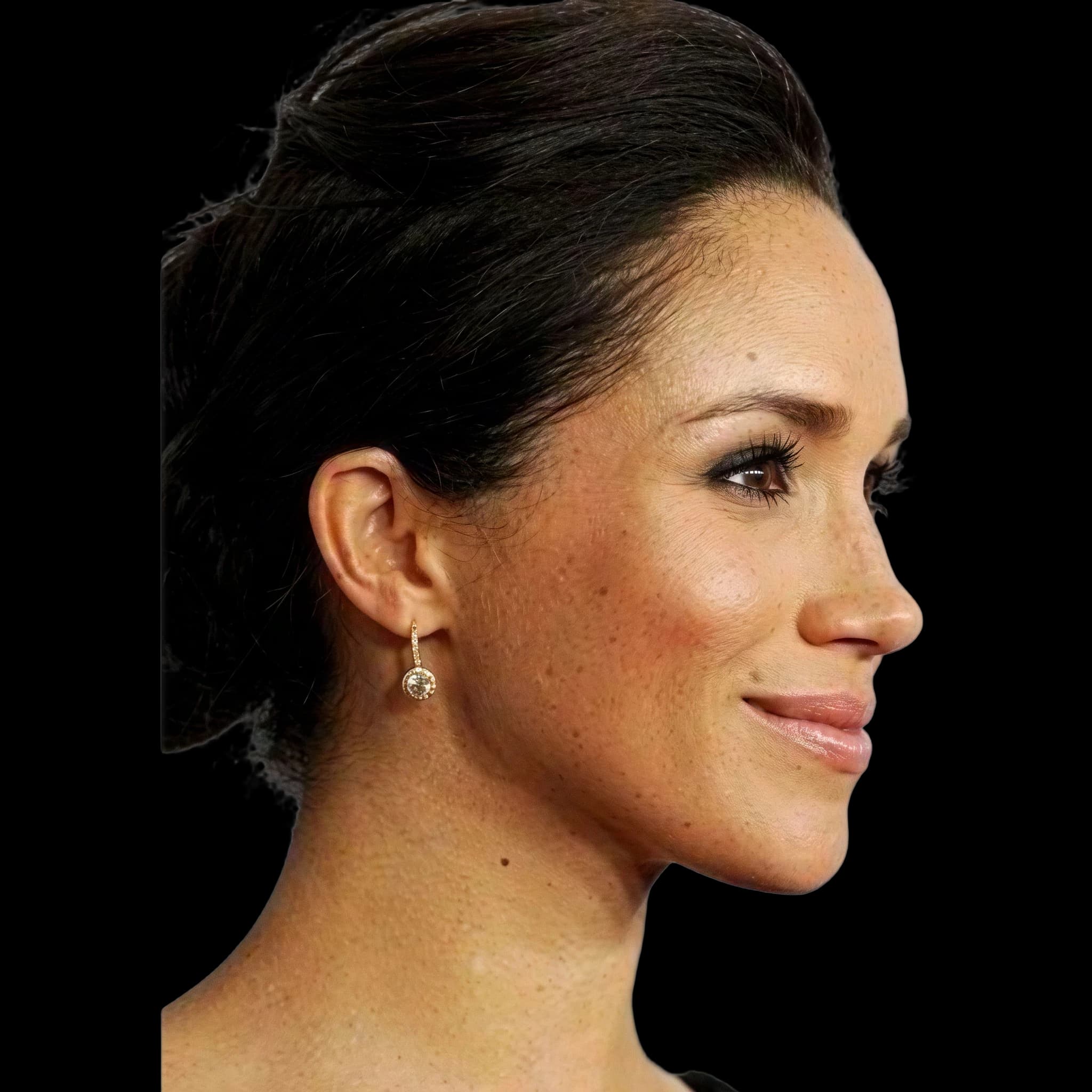 Meghan Markle, Submental Definition