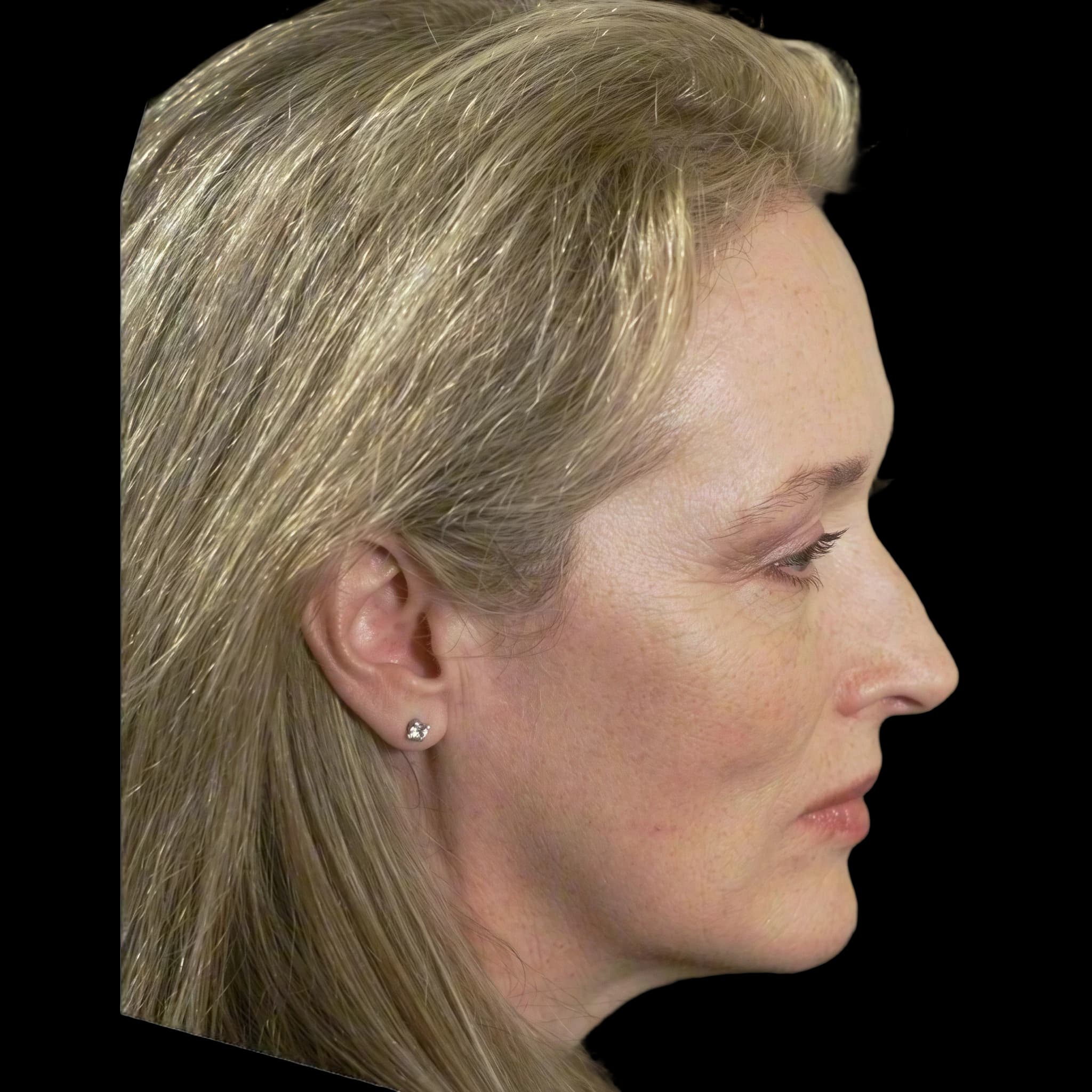 Meryl Streep, side profile