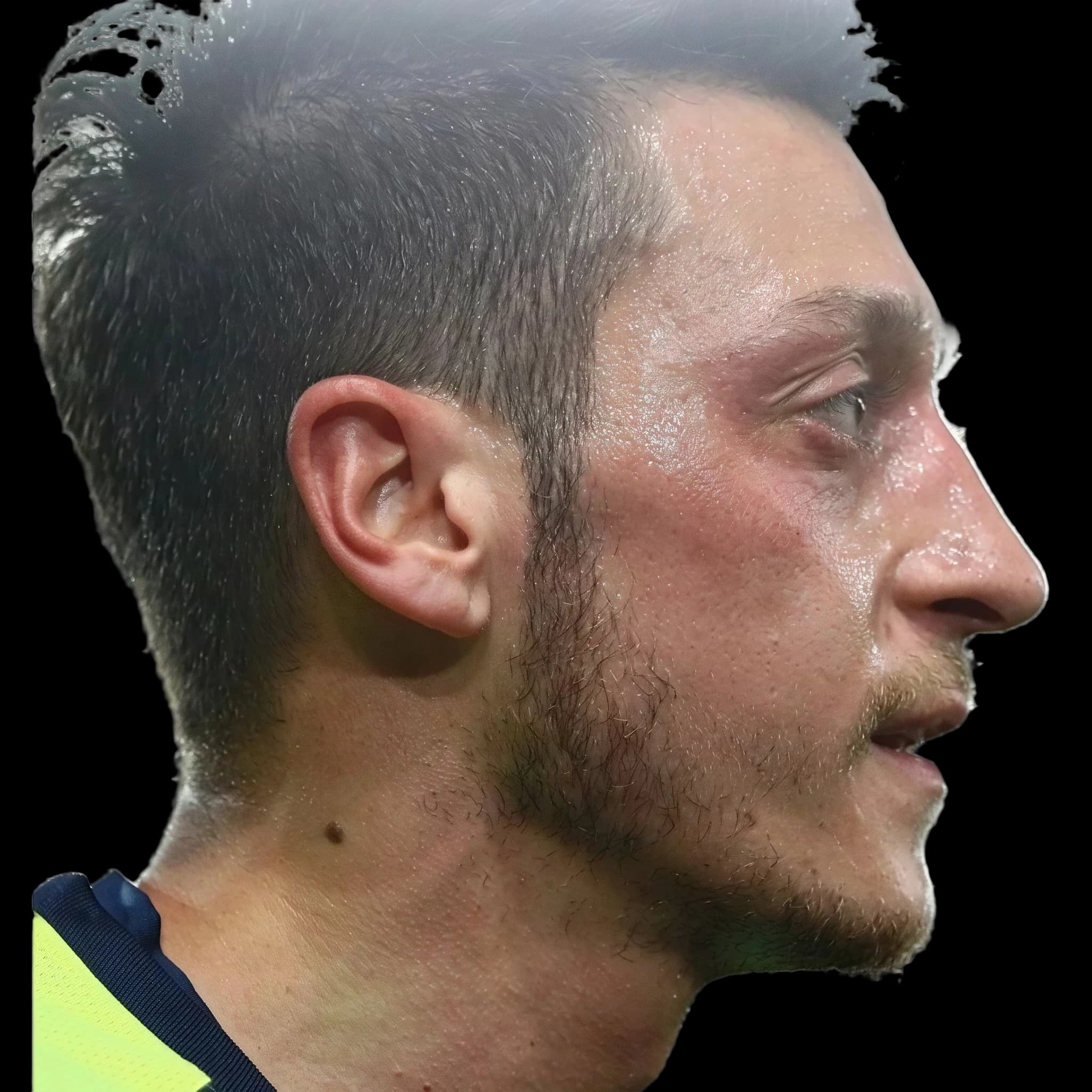 Mesut Özil, Upper Lip E-Line Position