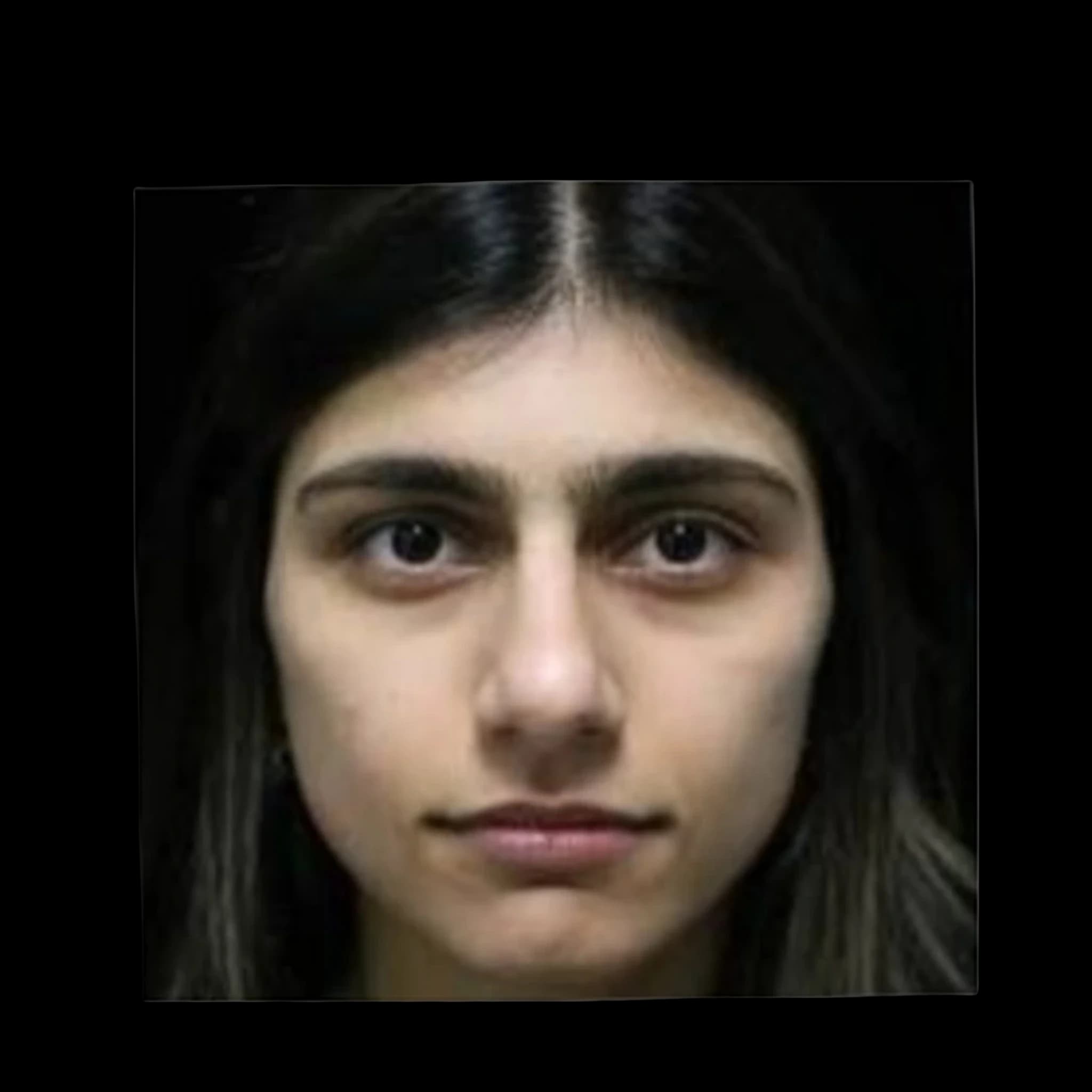 Mia Khalifa, Hyperpigmentation