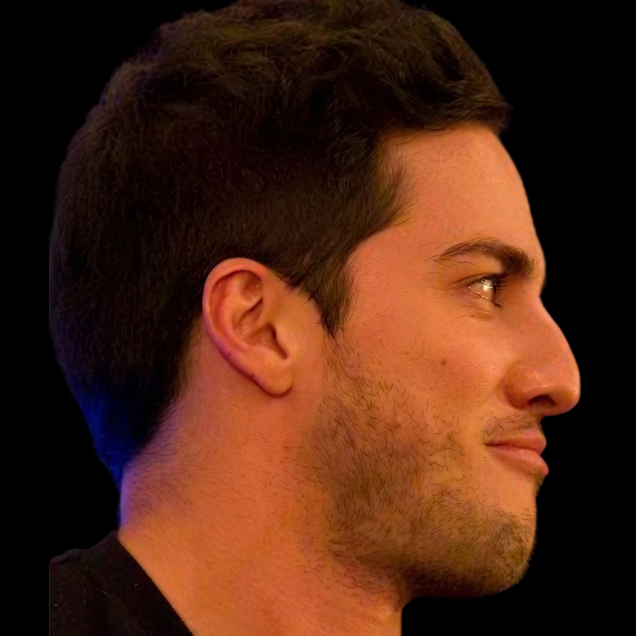 Michael Trevino, Submental Definition