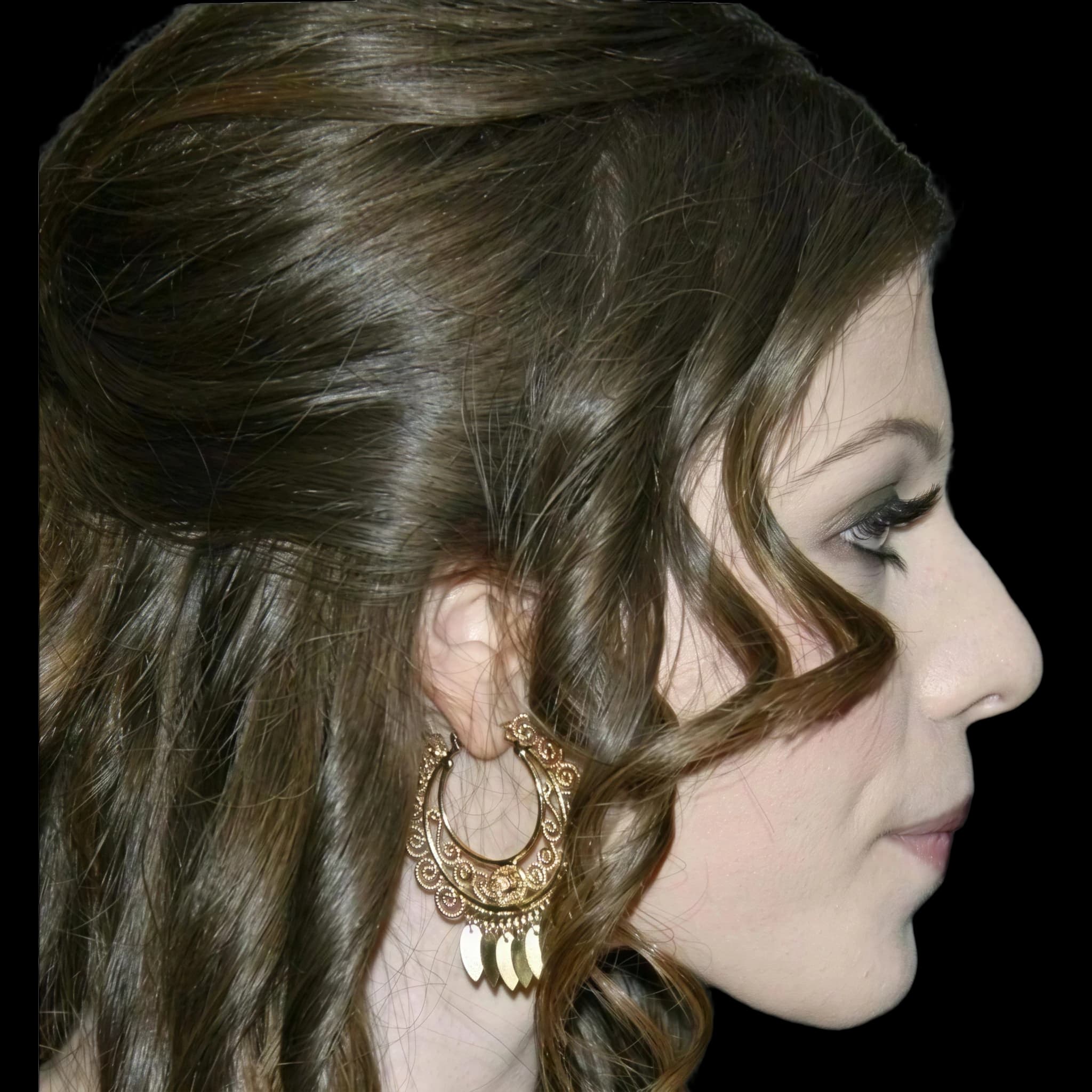 Michelle Trachtenberg, Submental Definition