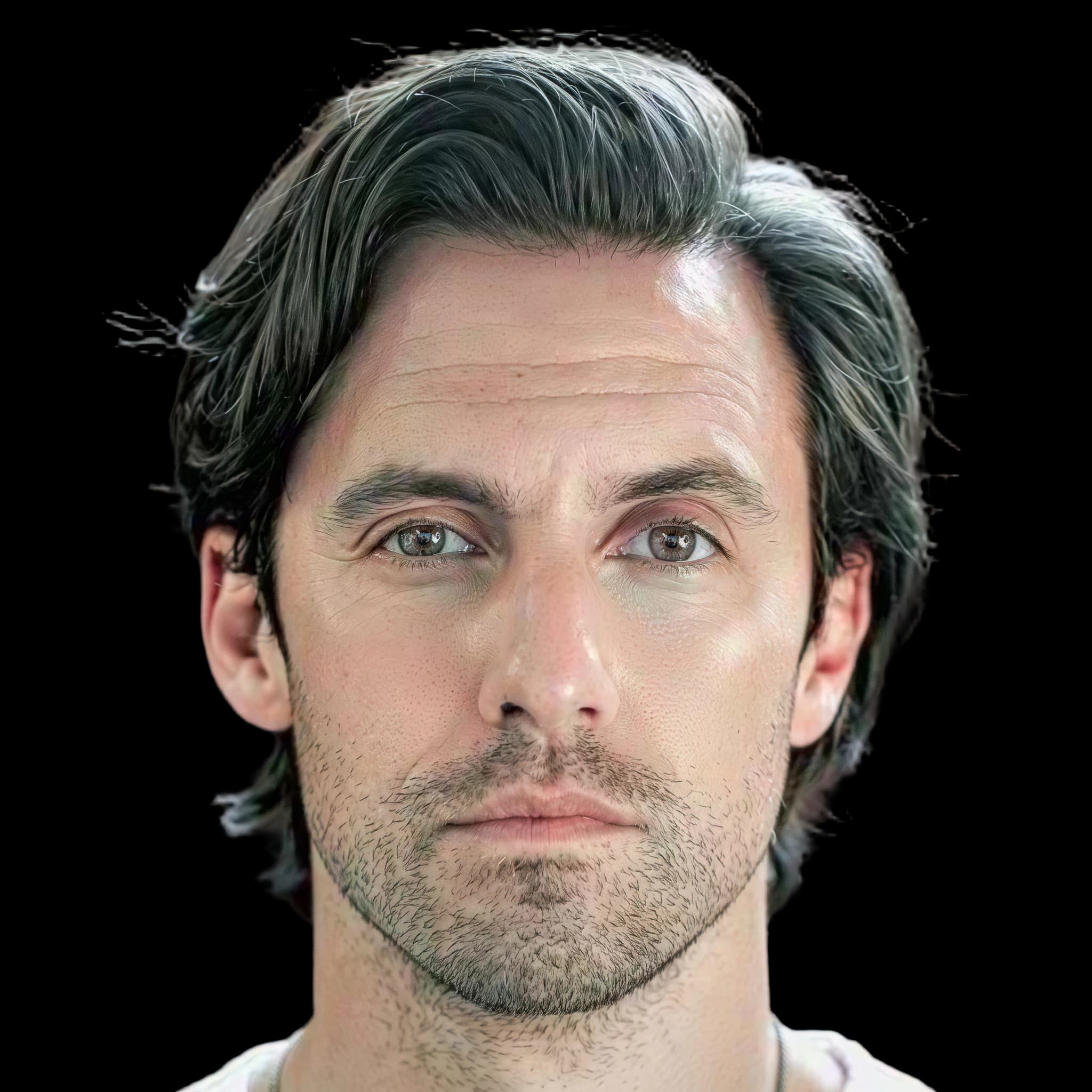 Milo Ventimiglia, Hyperpigmentation