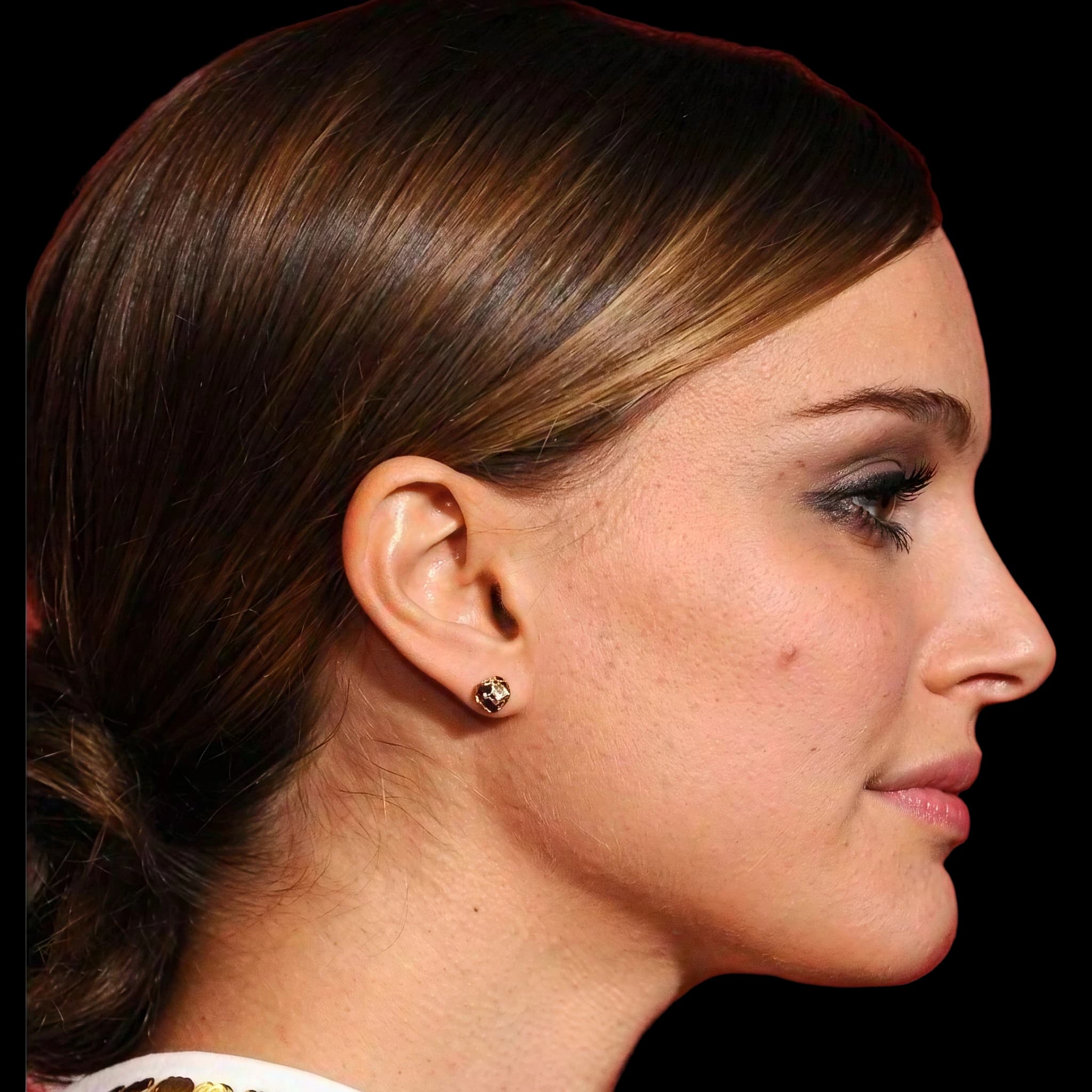 Natalie Portman, Submental Definition