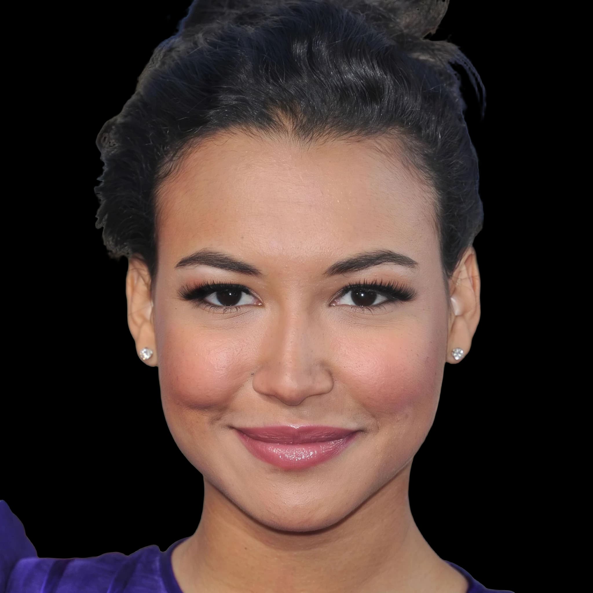 Naya Rivera, Hyperpigmentation