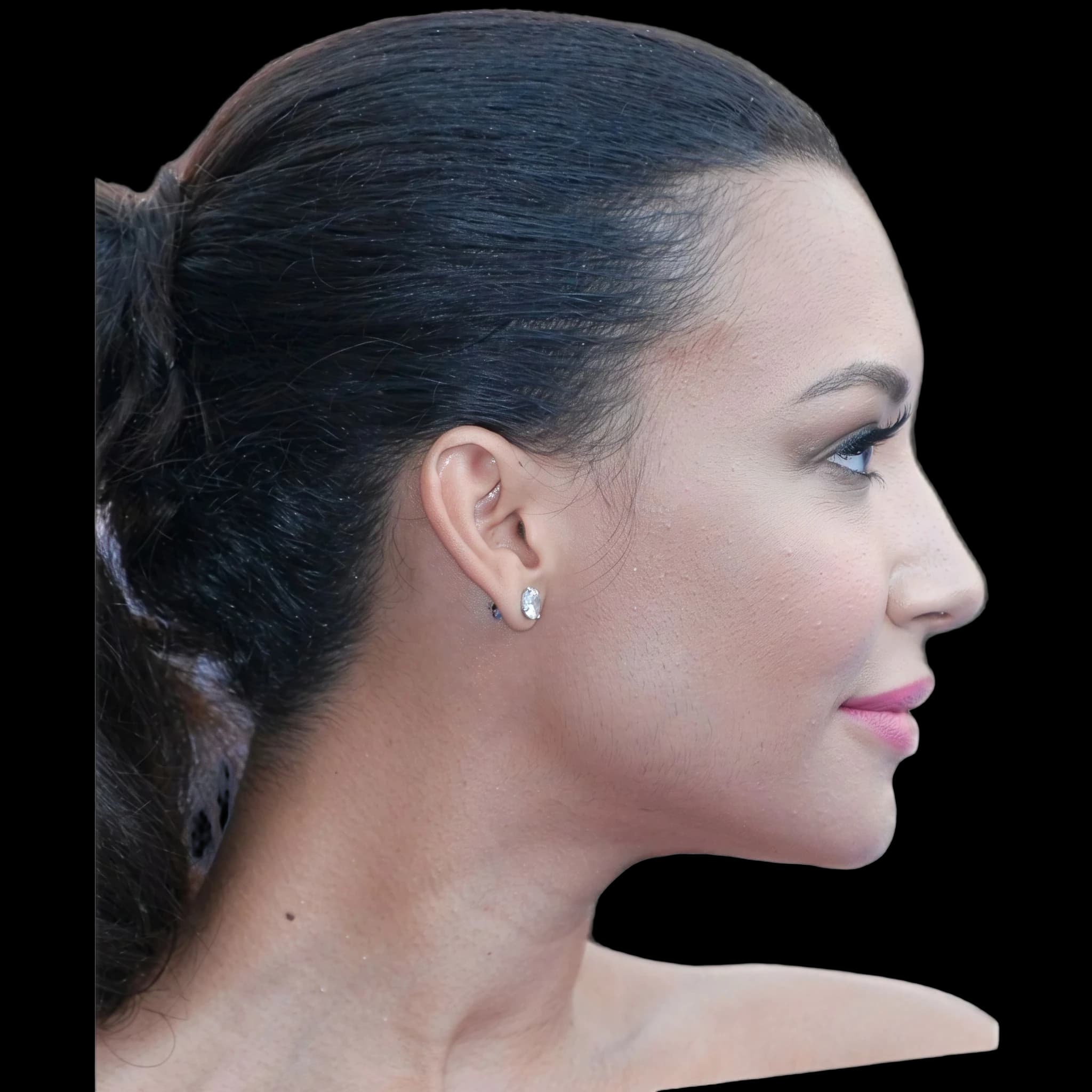 Naya Rivera, Eye Protrusion