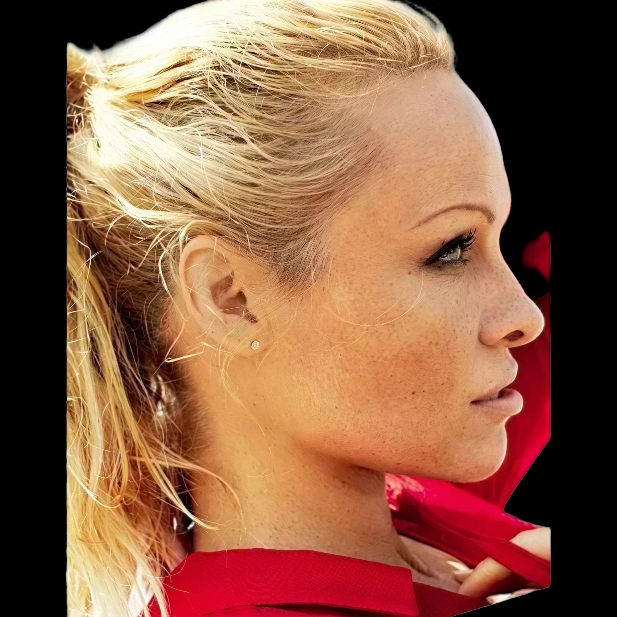 Pamela Anderson, Submental Definition