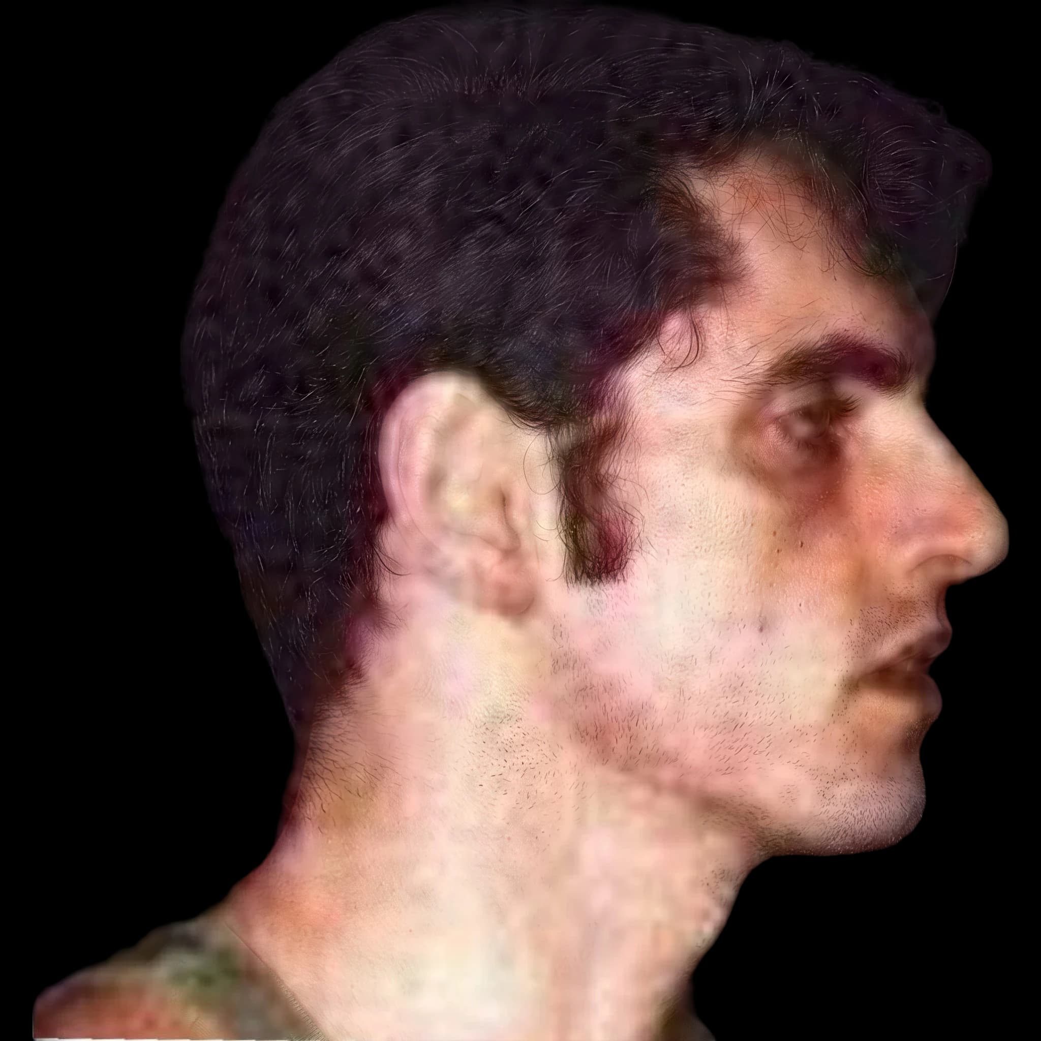 Pete Steele, Nasal Tip Angle